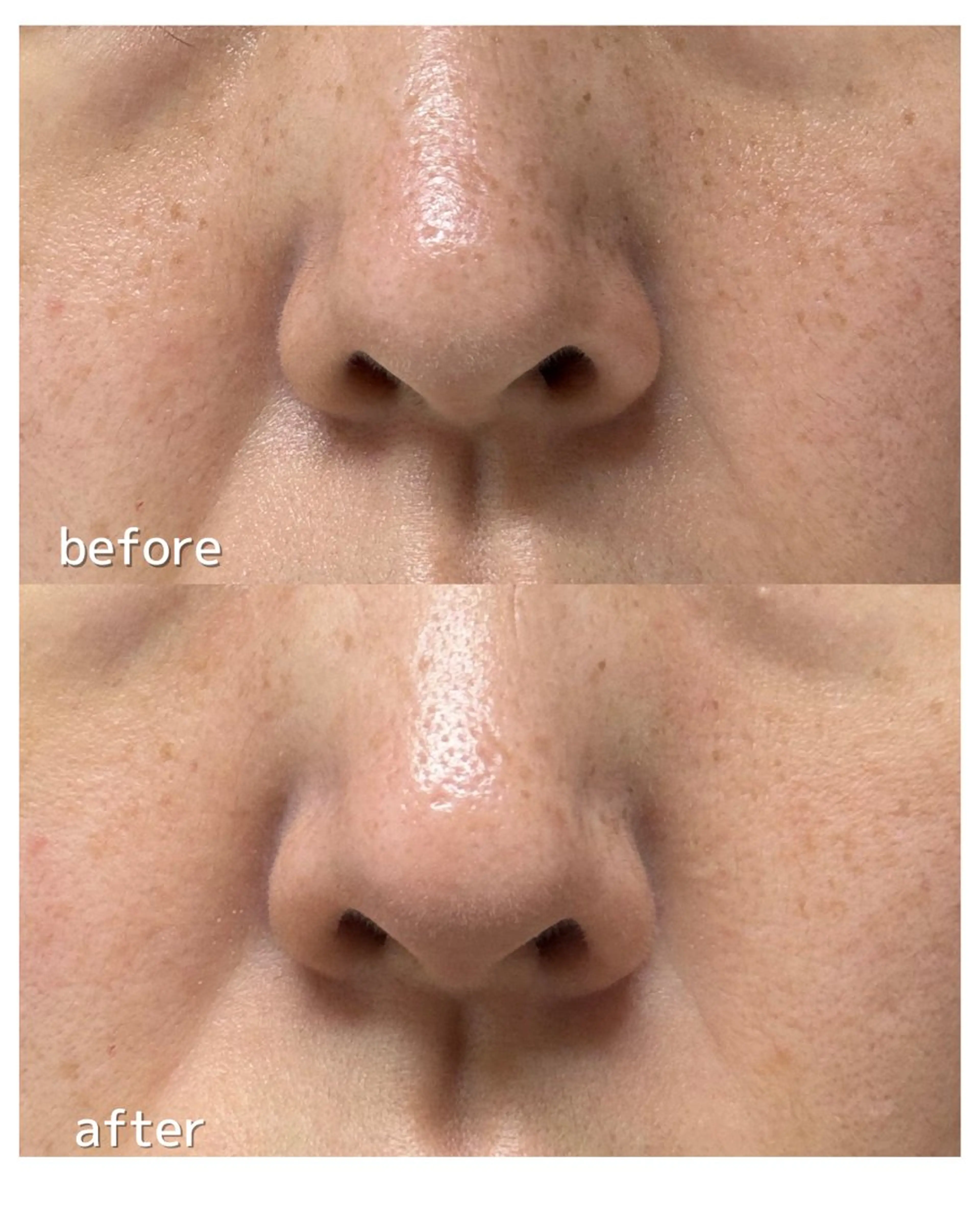 BellaLuna NAILのネイルデザイン