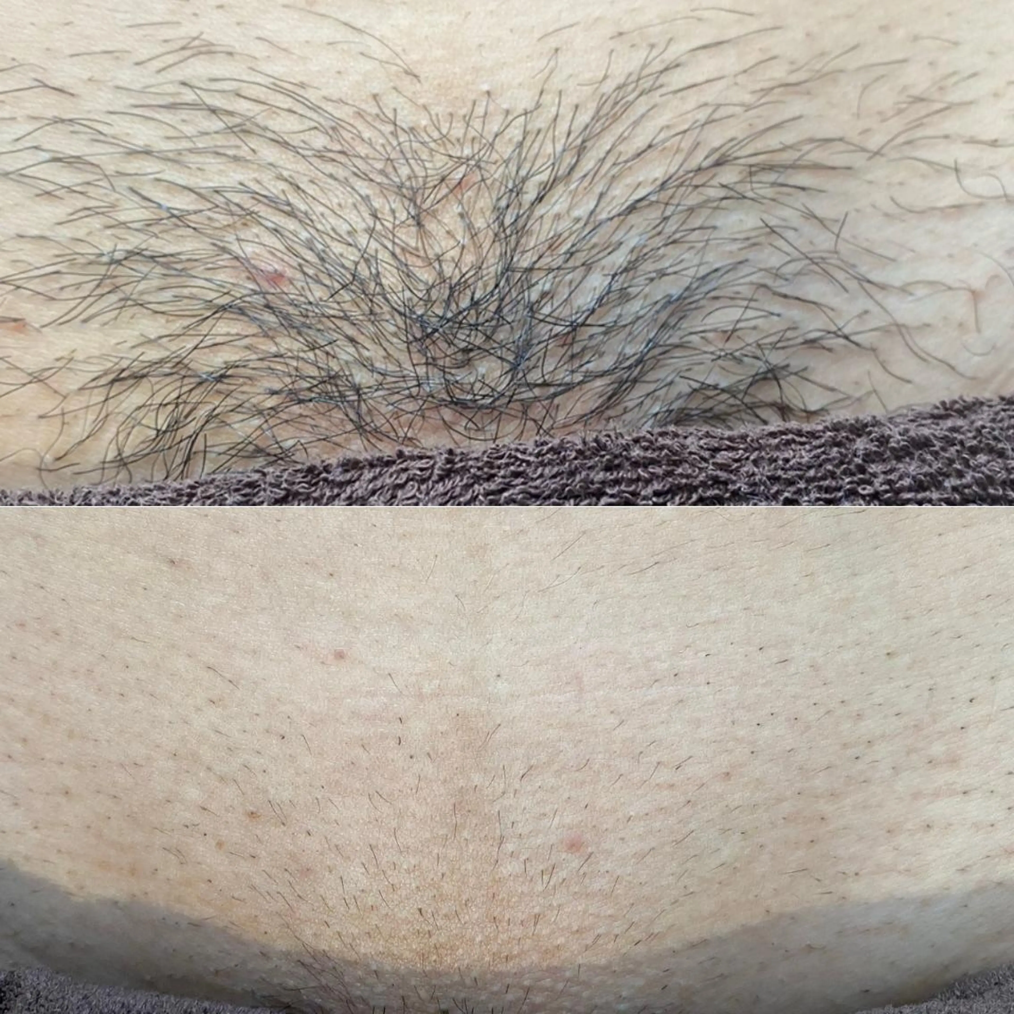 脱毛 シエスタ 山下 上級脱毛士のエステ・リラクイメージ