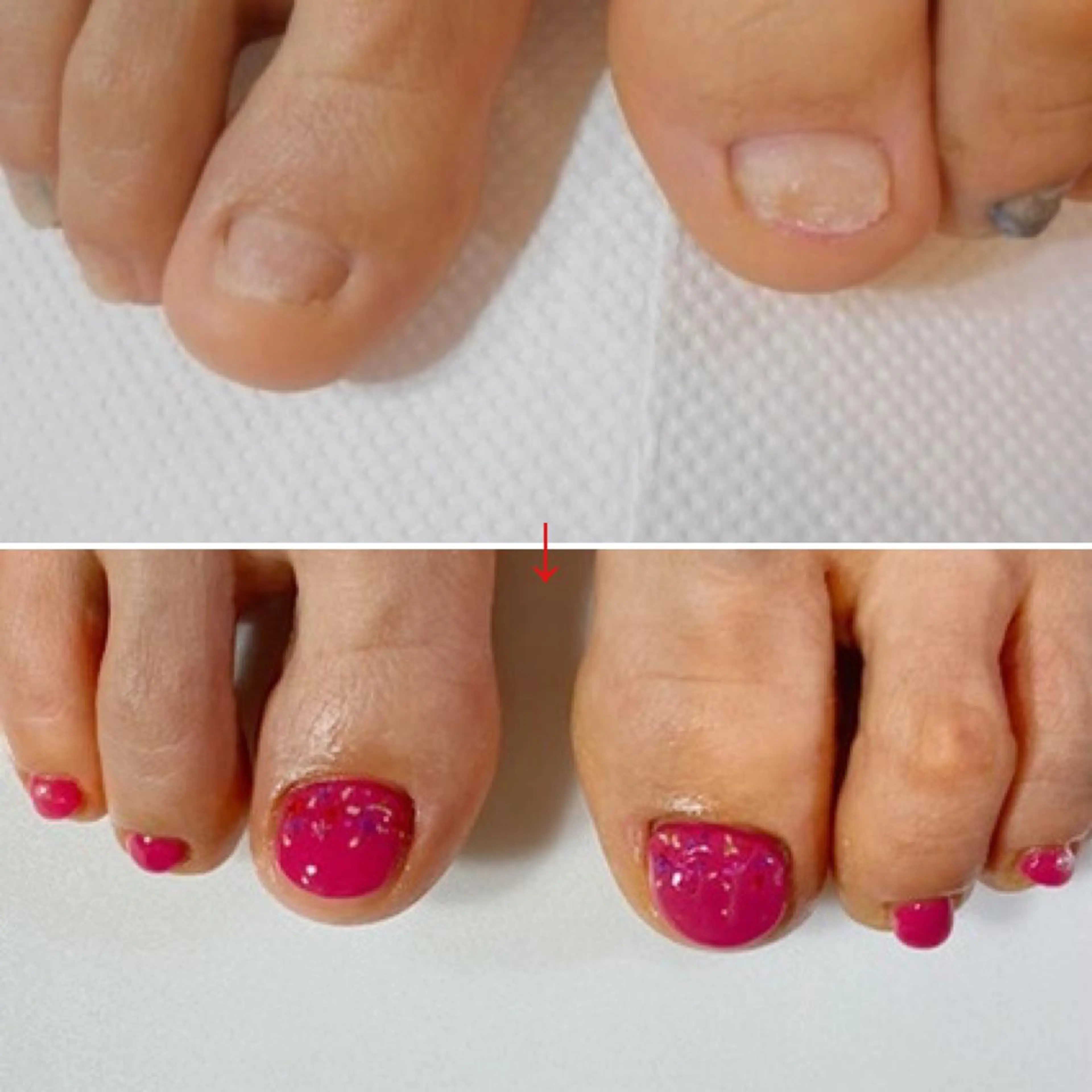 ネイル アートネイル フットネイル ネイルサロン アリュームのネイルデザイン