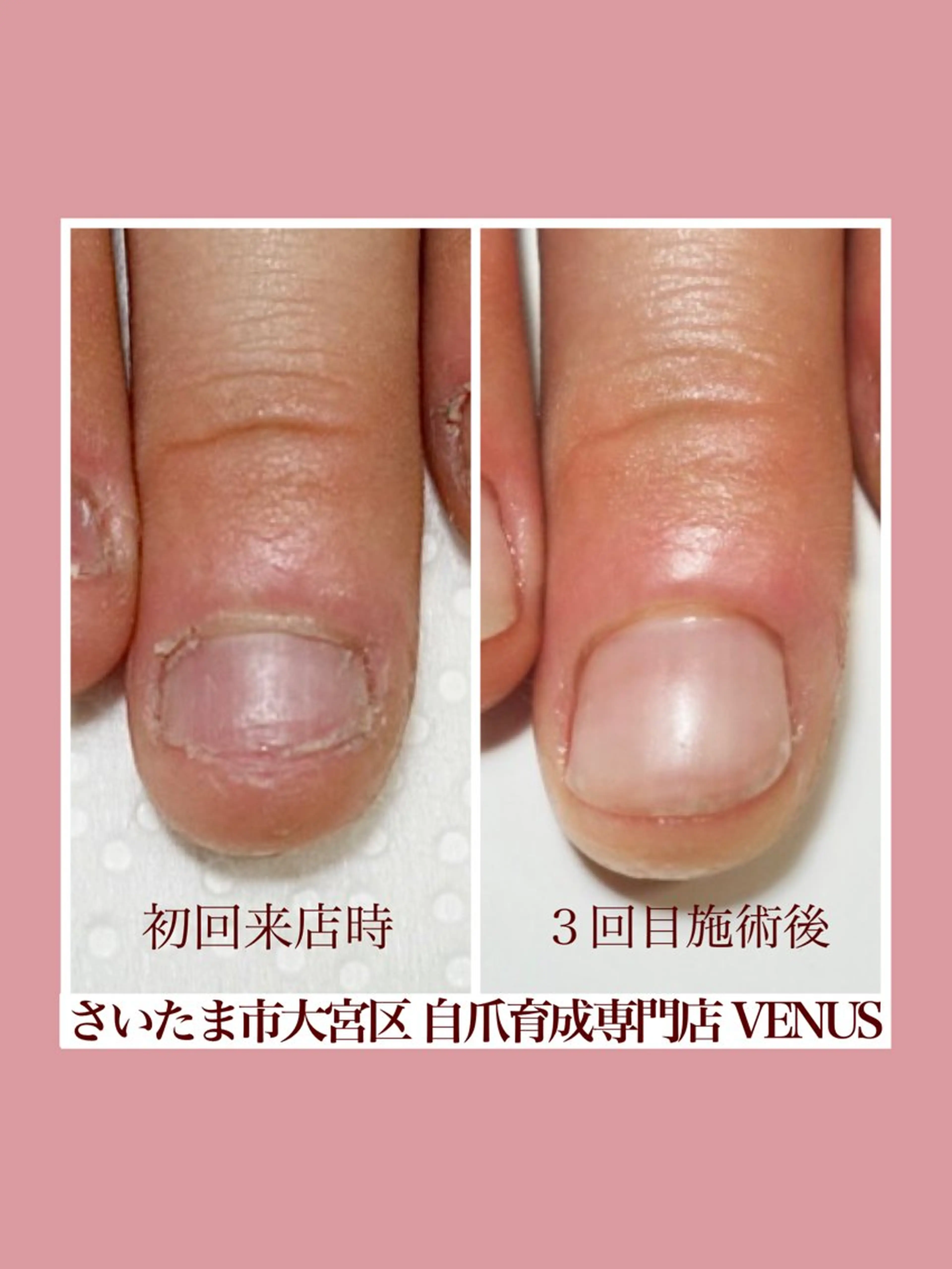 ネイル ハンドネイル ハンドケア nailsalon VENUSのネイルデザイン