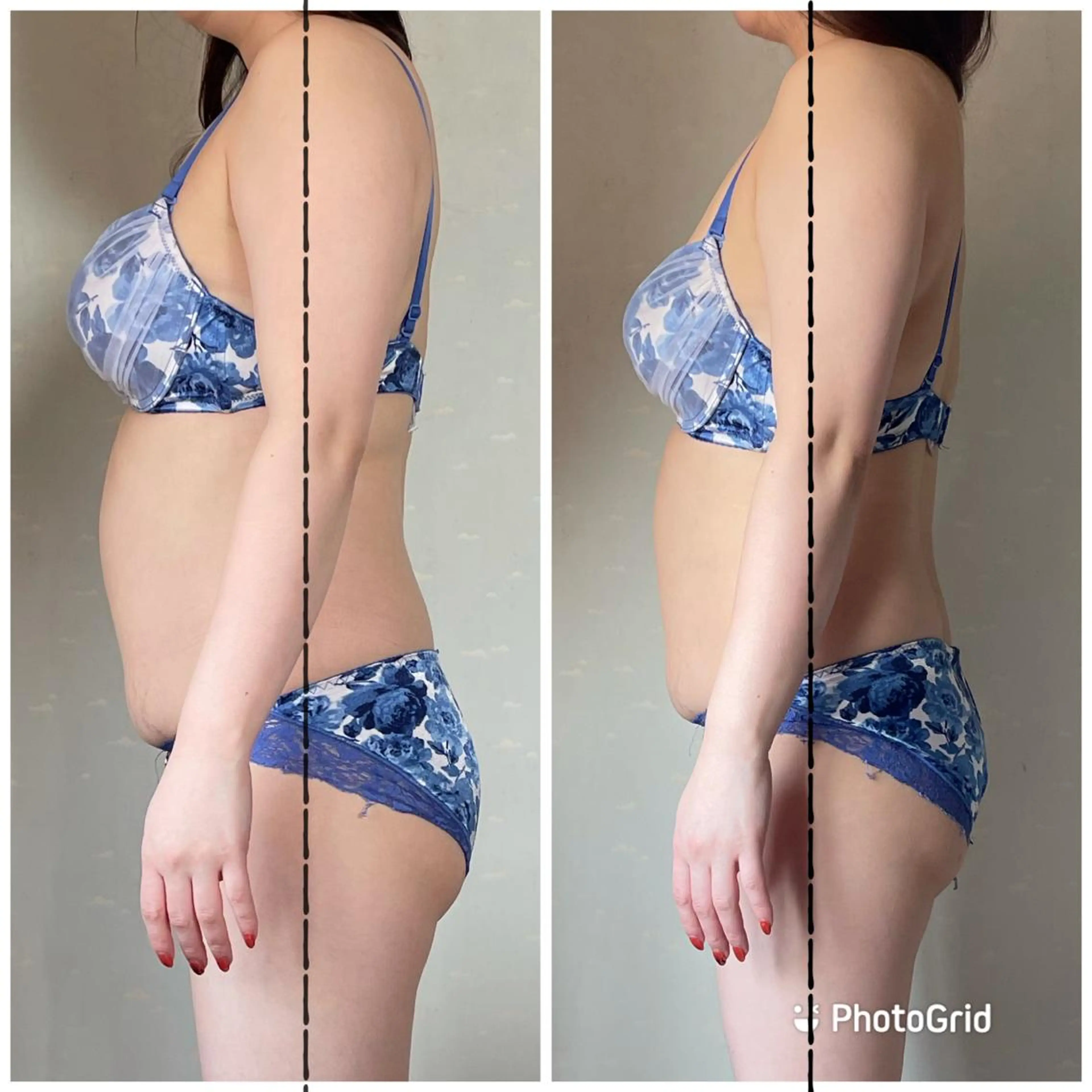 あだち整体エステ 首肩背中のゆるめぐのエステ・リラクイメージ