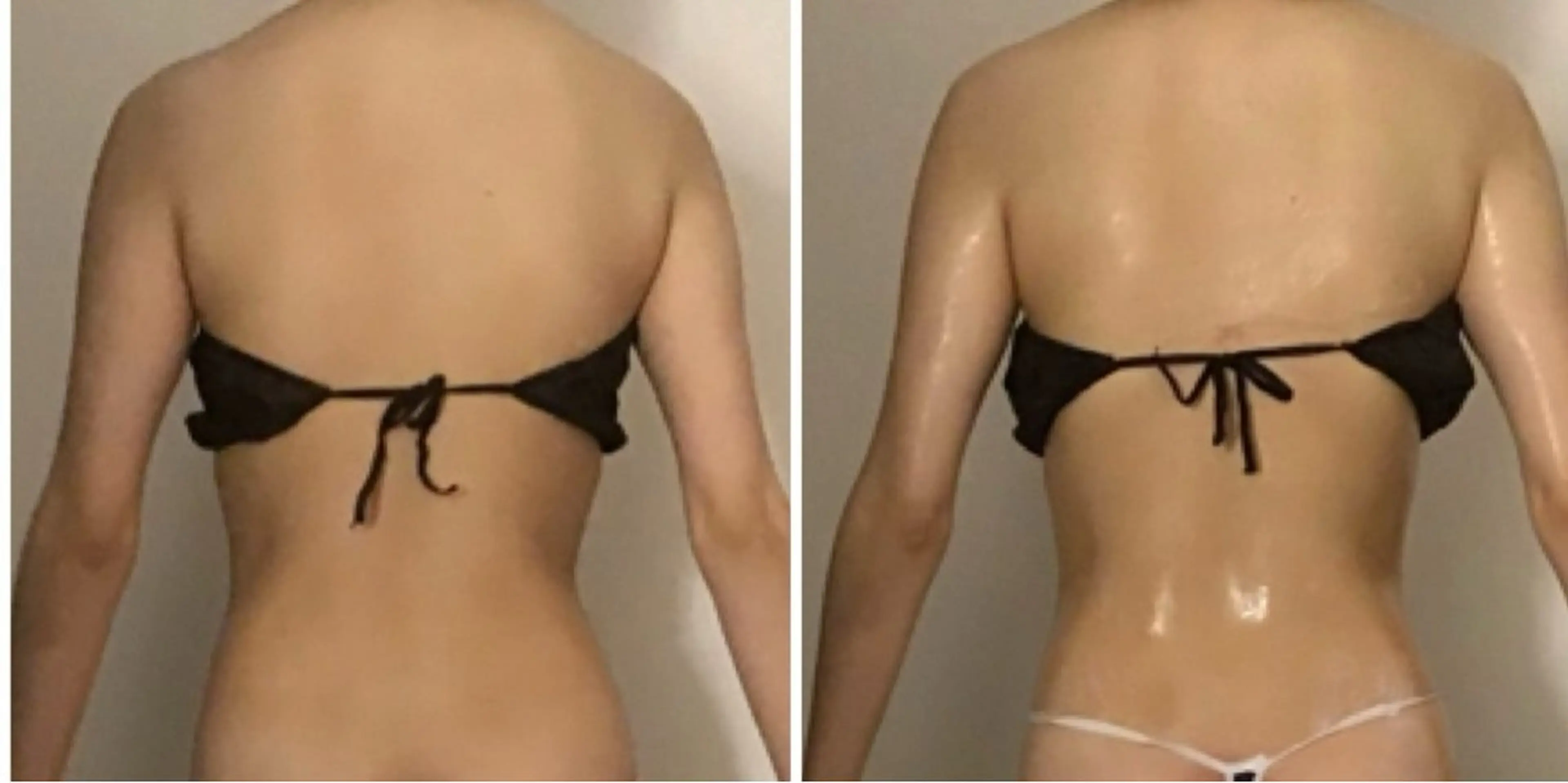 エステ リラク BELLEFINE 💕痩身・小顔・脱毛のエステ・リラクイメージ