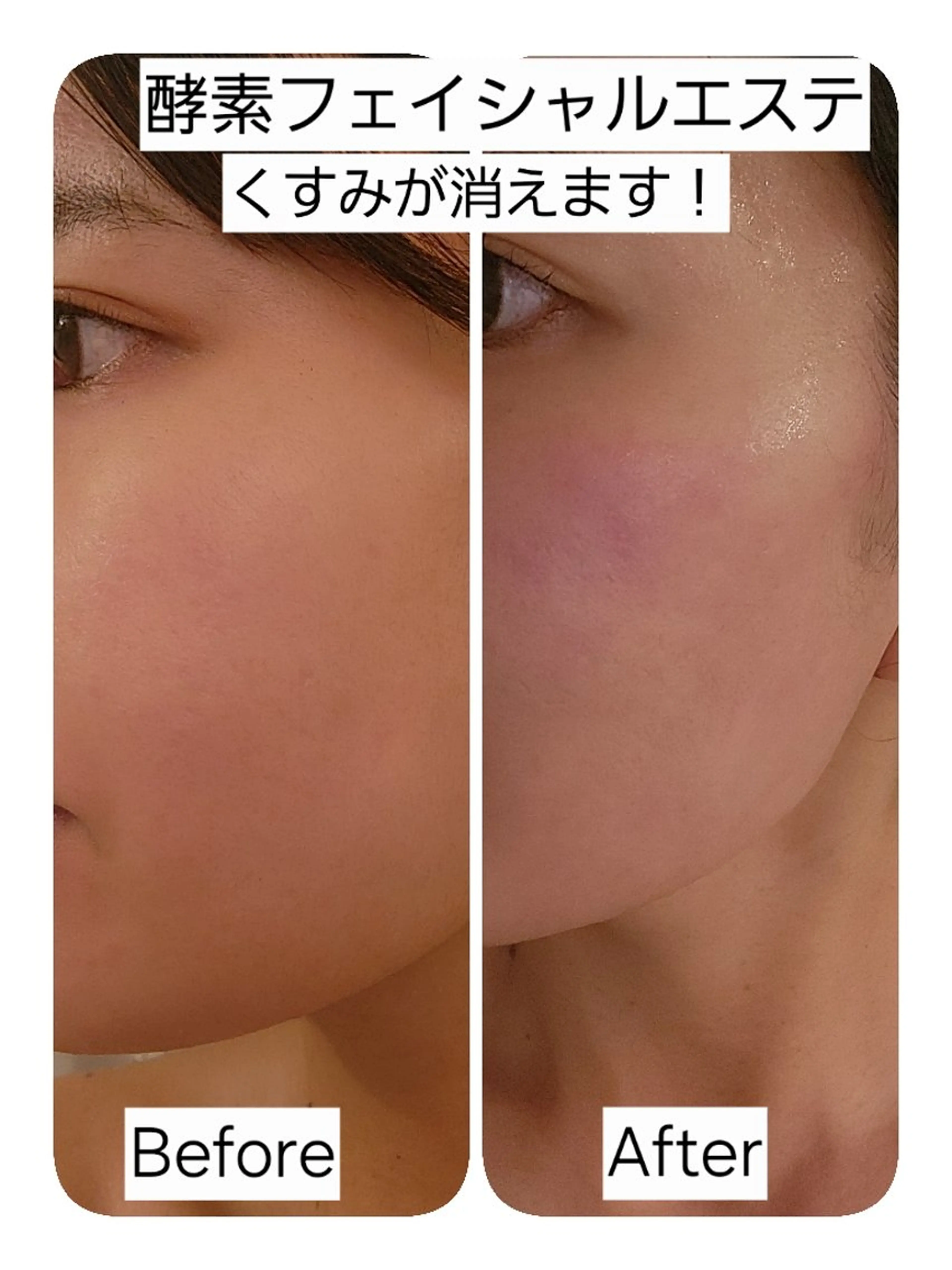 肌質改善サロン Perteのエステ・リラクイメージ