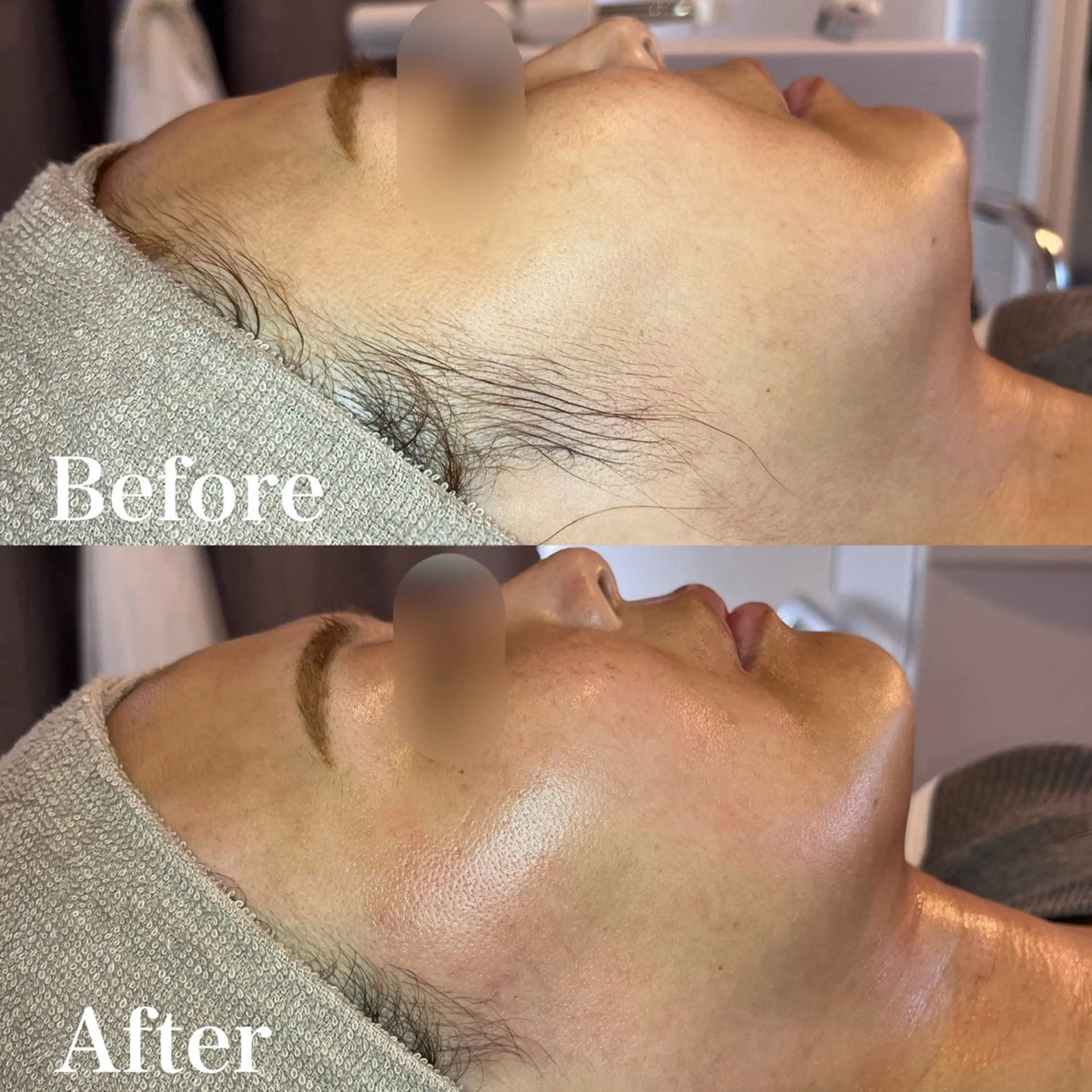 脱毛 wax脱毛専門店 ハイラントのエステ・リラクイメージ