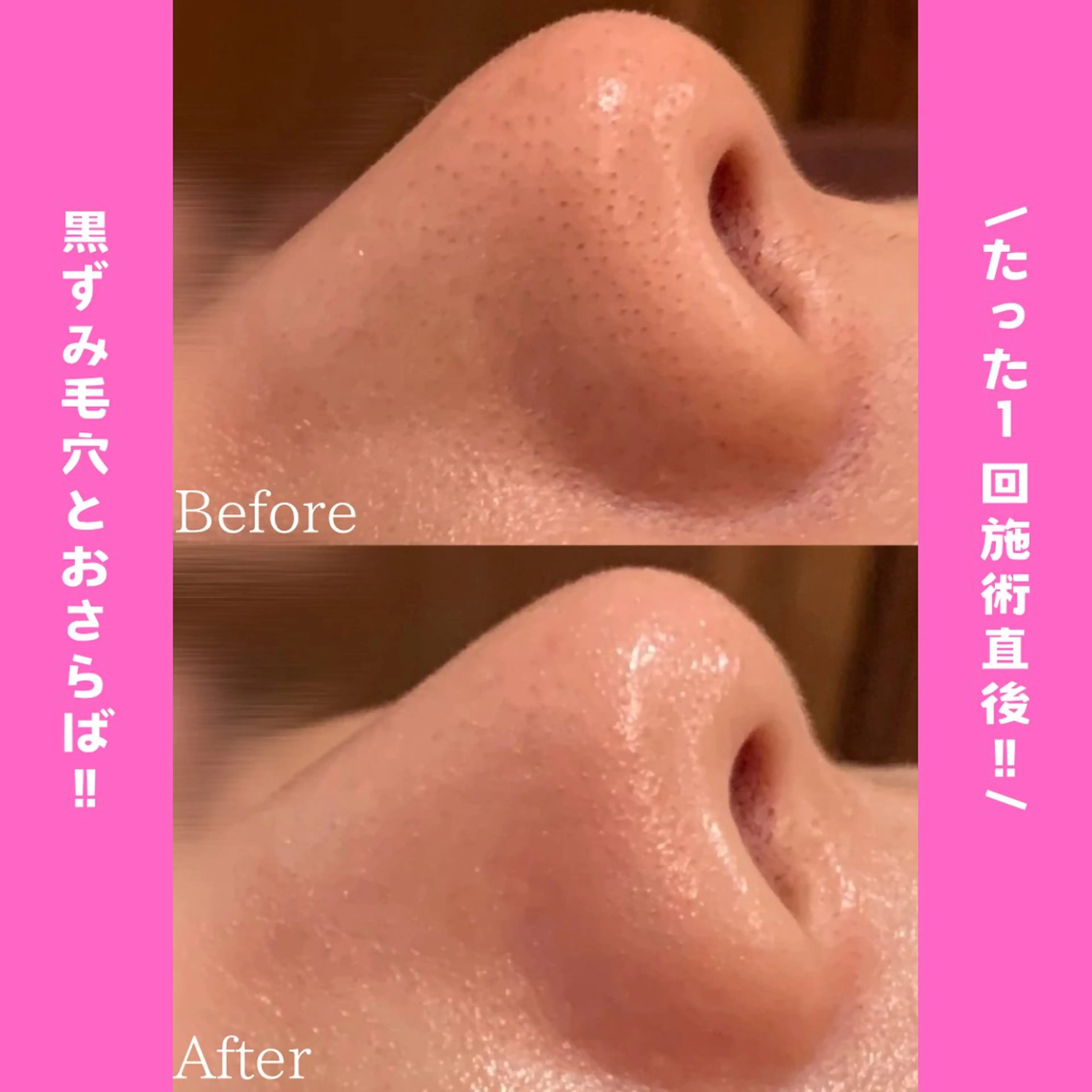 痩身&美肌サロン 堀米✨のその他イメージ