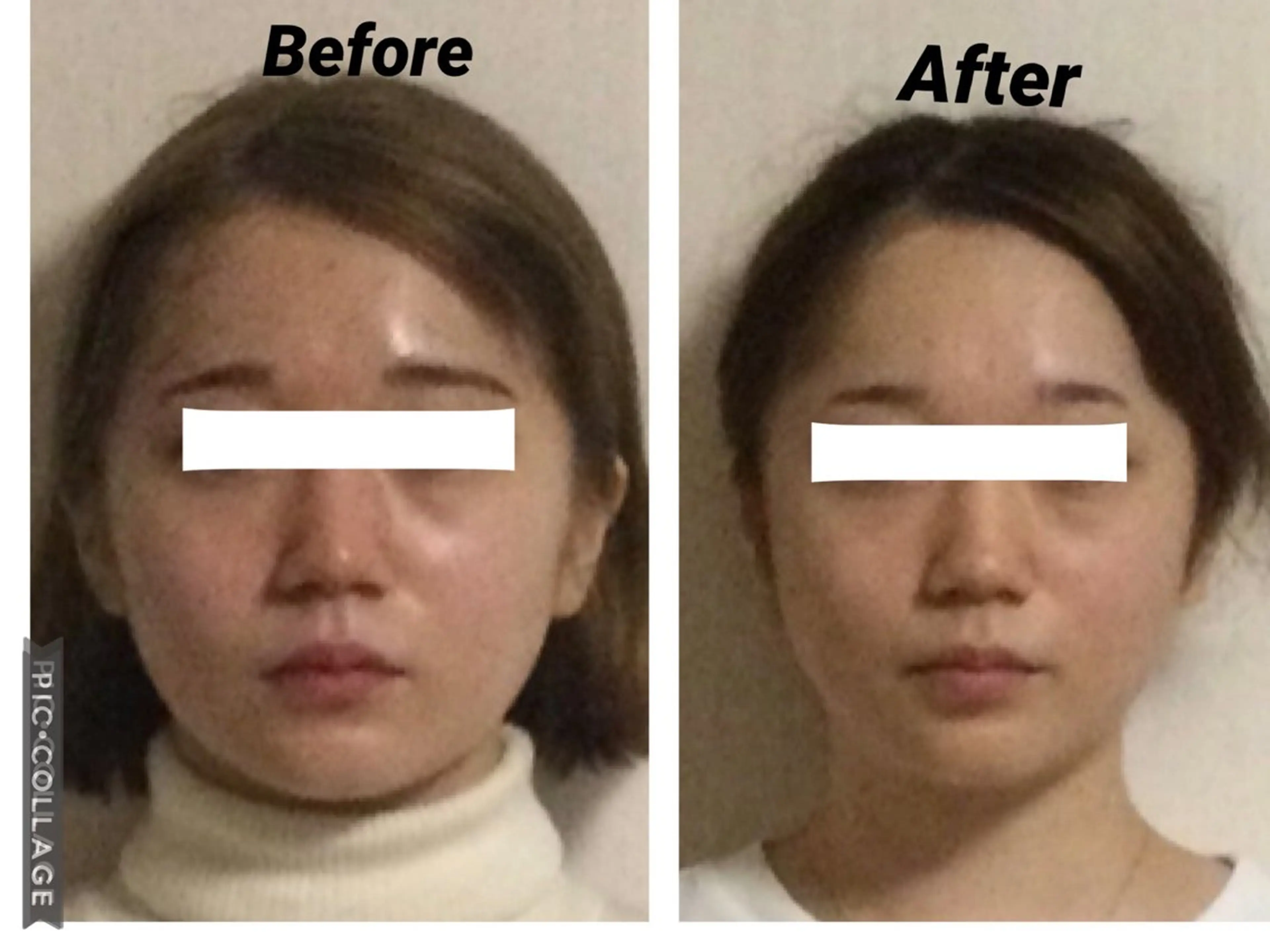 エステ リラク 小顔矯正Sho  FaceDesignのエステ・リラクイメージ