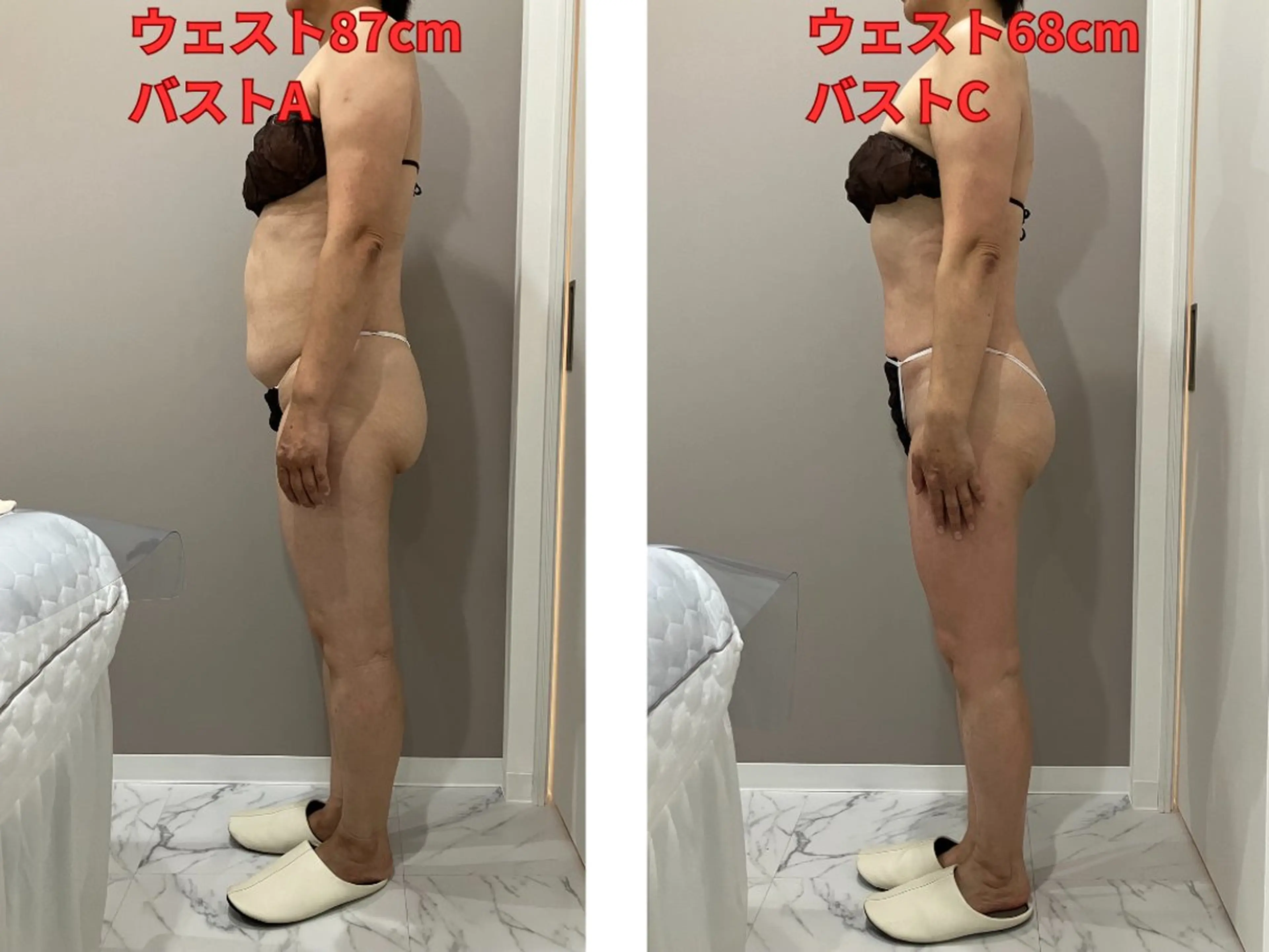 エステ 【痩身/ダイエット】 オーバイワン横浜🍓のエステ・リラクイメージ