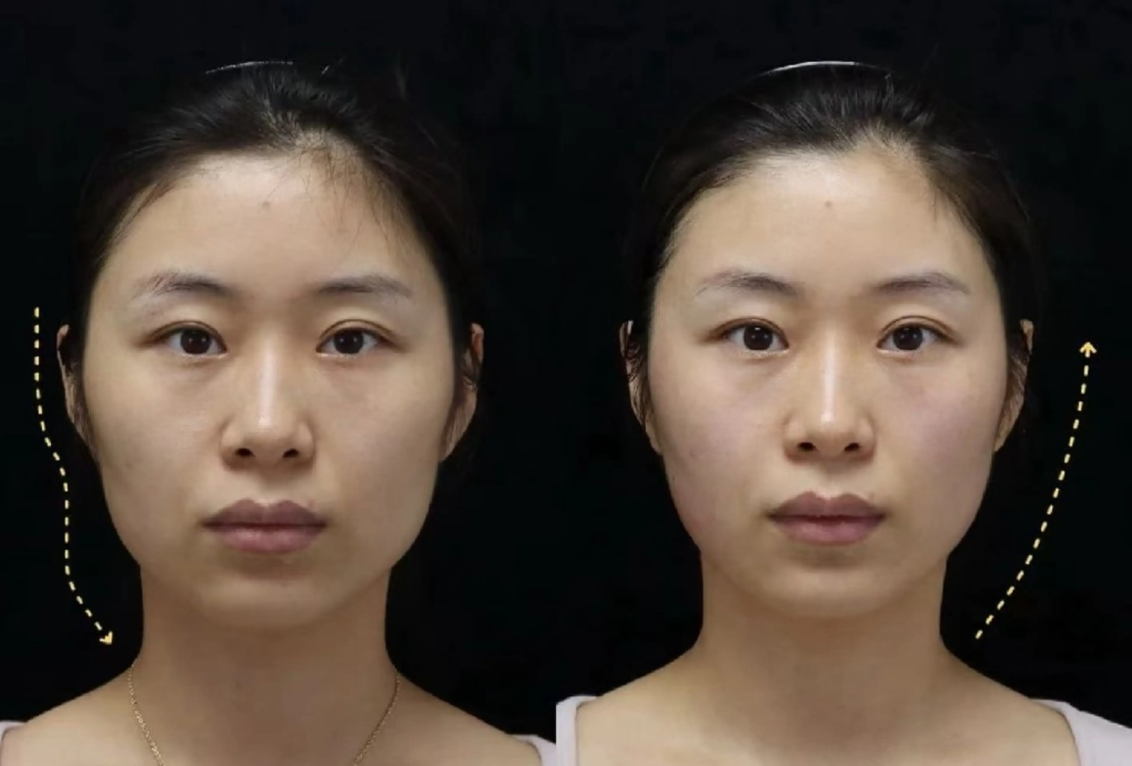 エステ aliaハーブ水光店 エステティシャン募集のエステ・リラクイメージ