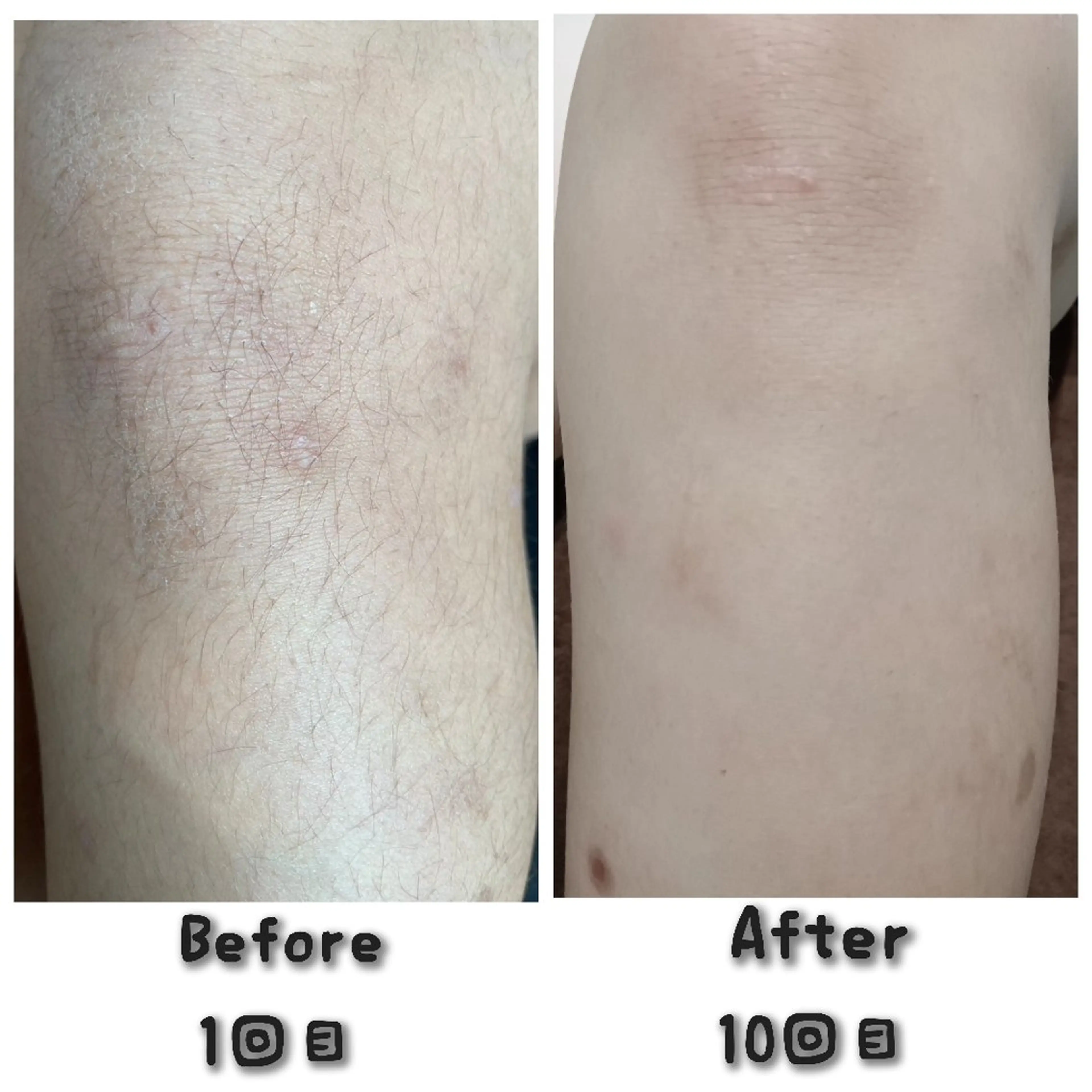 キッズ エステティクサロン Moon-bellのエステ・リラクイメージ