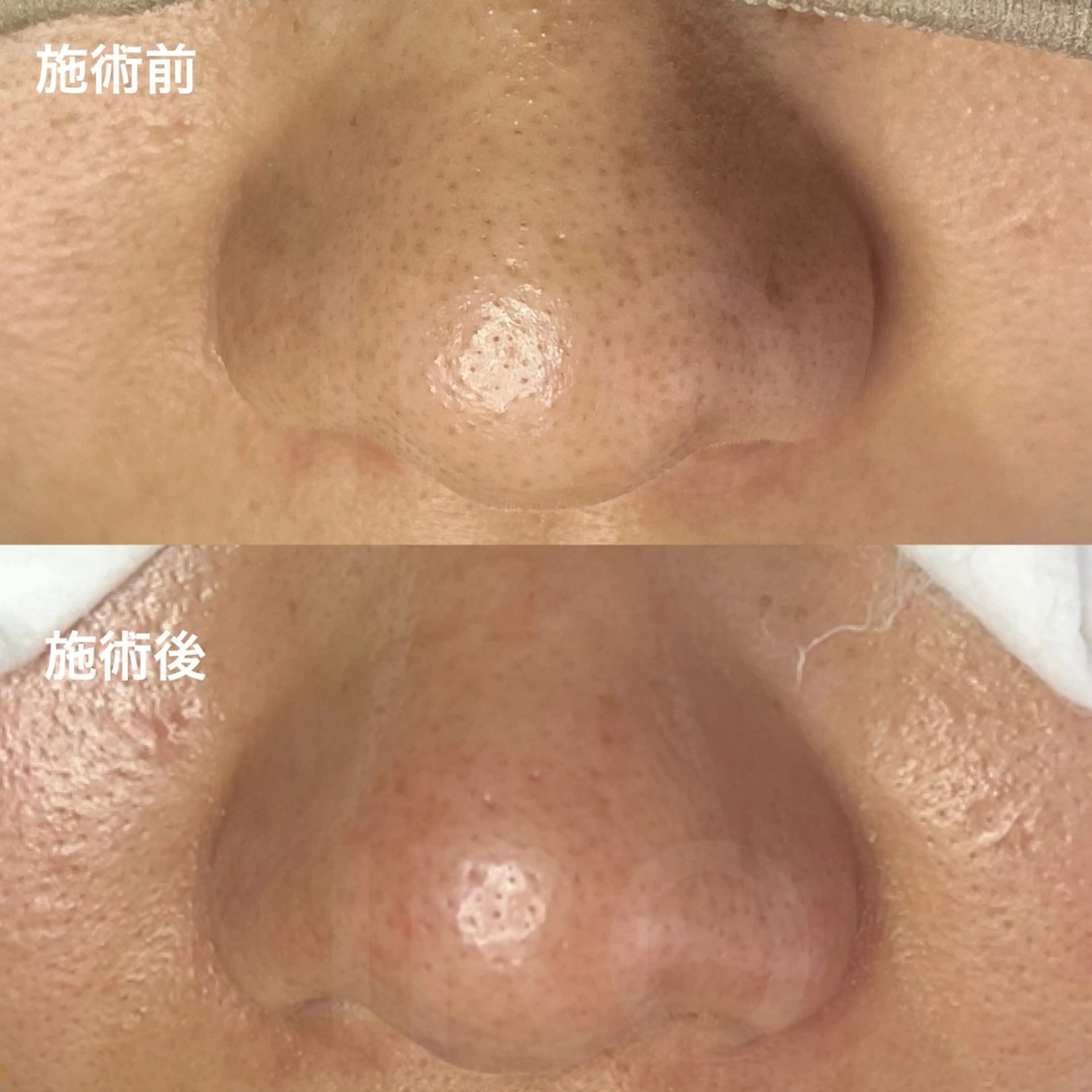 IRO KANAのマツエク・マツパデザイン