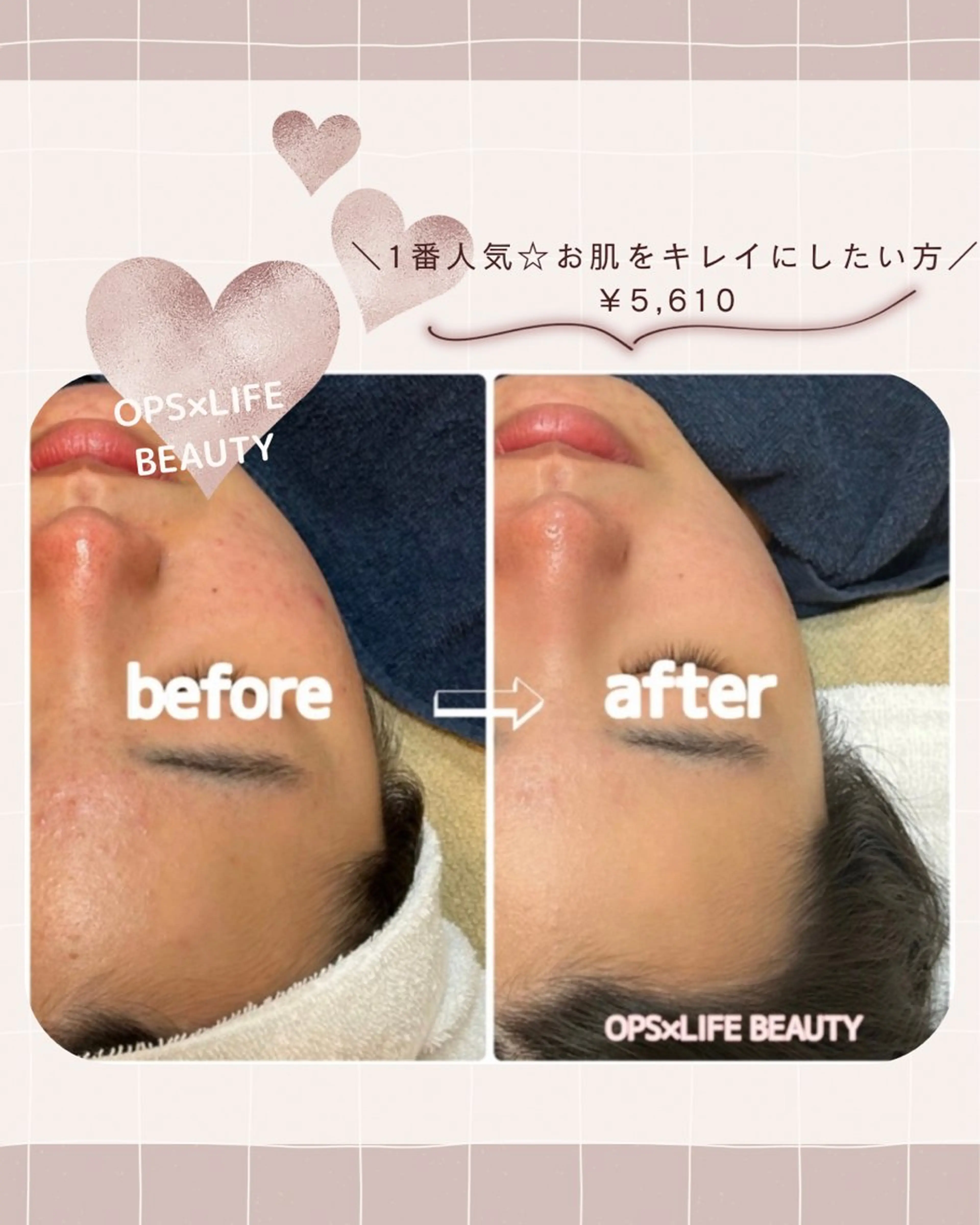 エステ リラク OPS×LIFE BEAUTY/maiのエステ・リラクイメージ