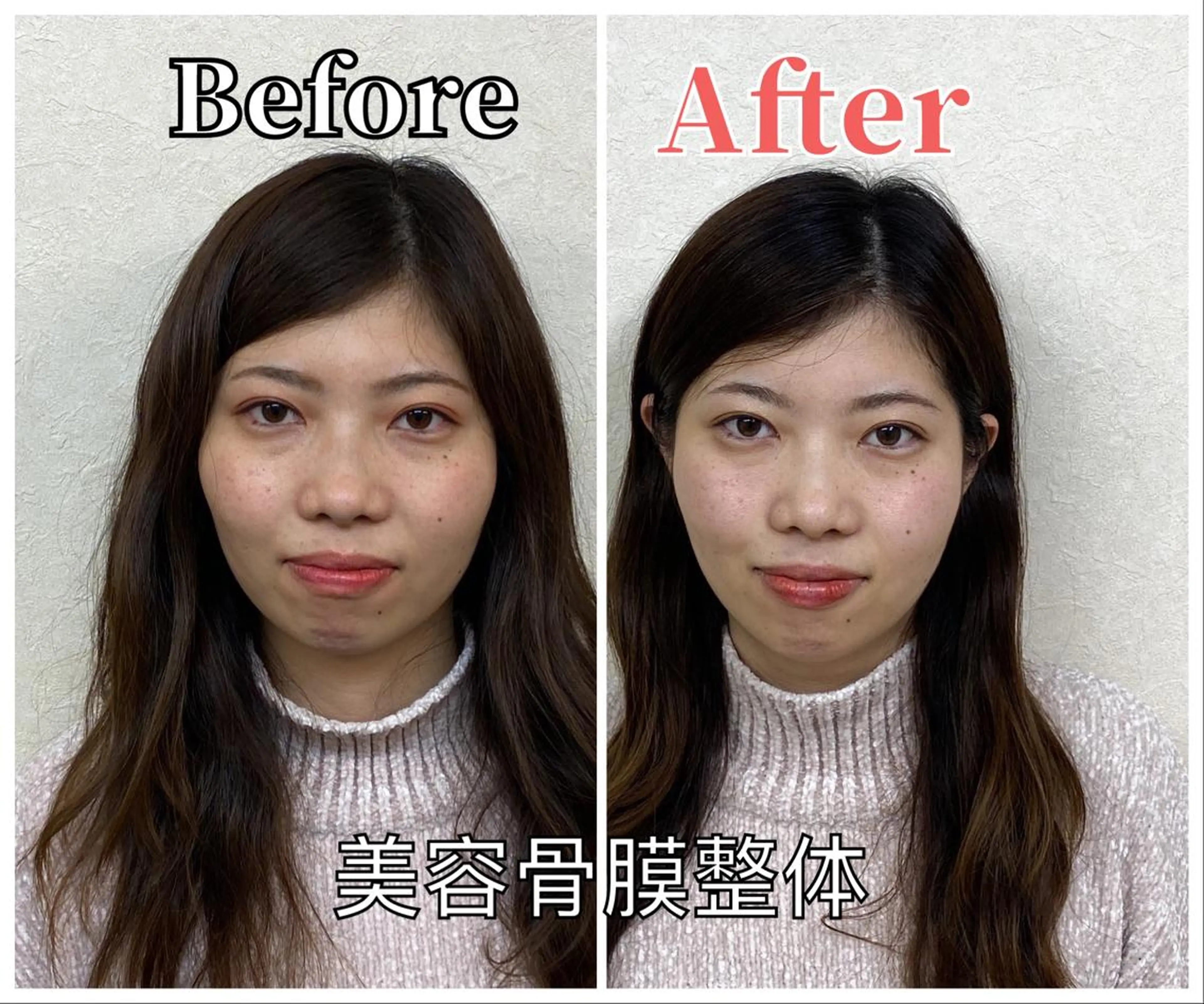 ⭐️初回モニター限定⭐️頭蓋骨小顔矯正コース✨の写真