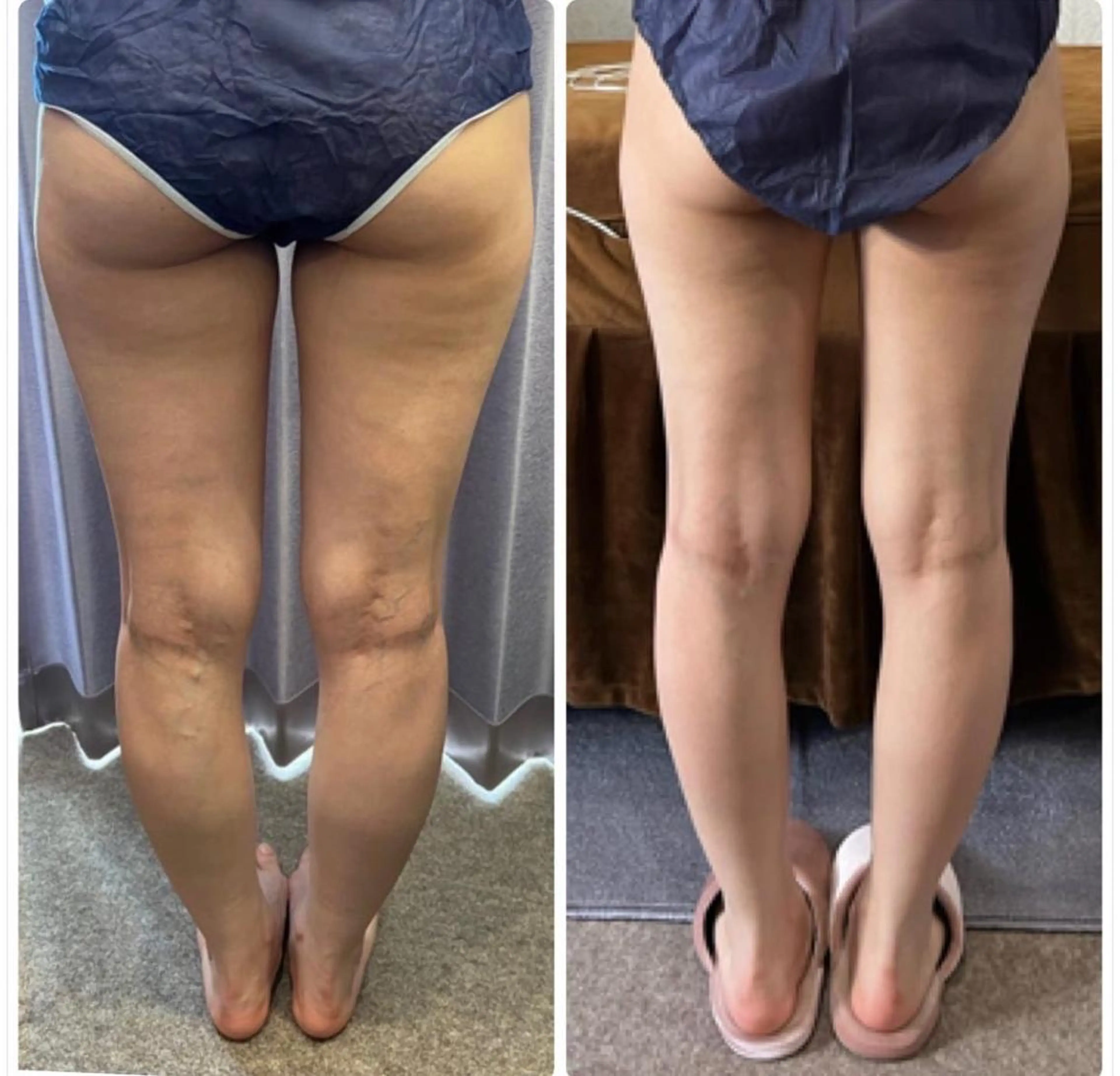 FLEUR 2号店のエステ・リラクイメージ