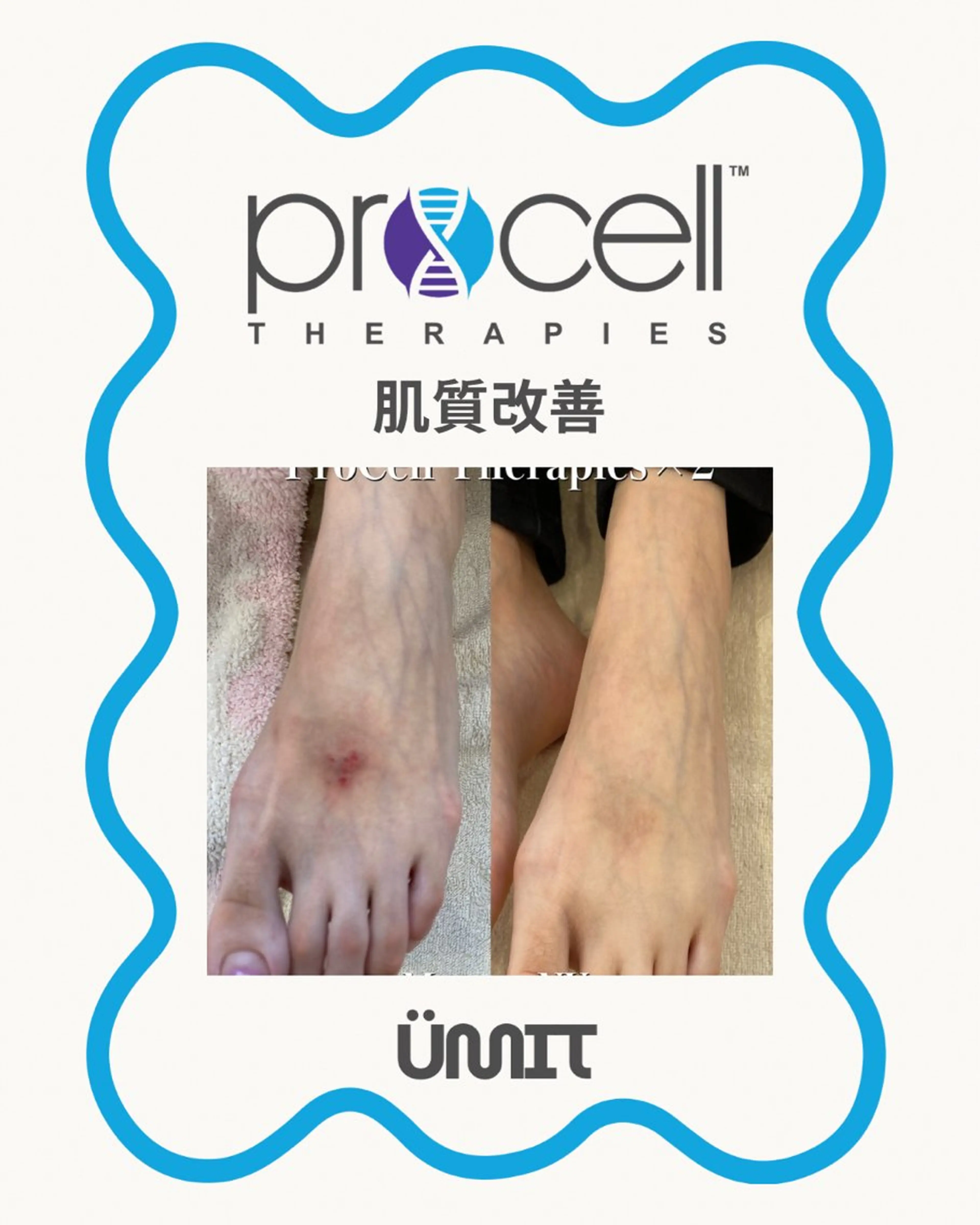 エステ Ümit（ユミト） プロセルセラピーズのネイルデザイン