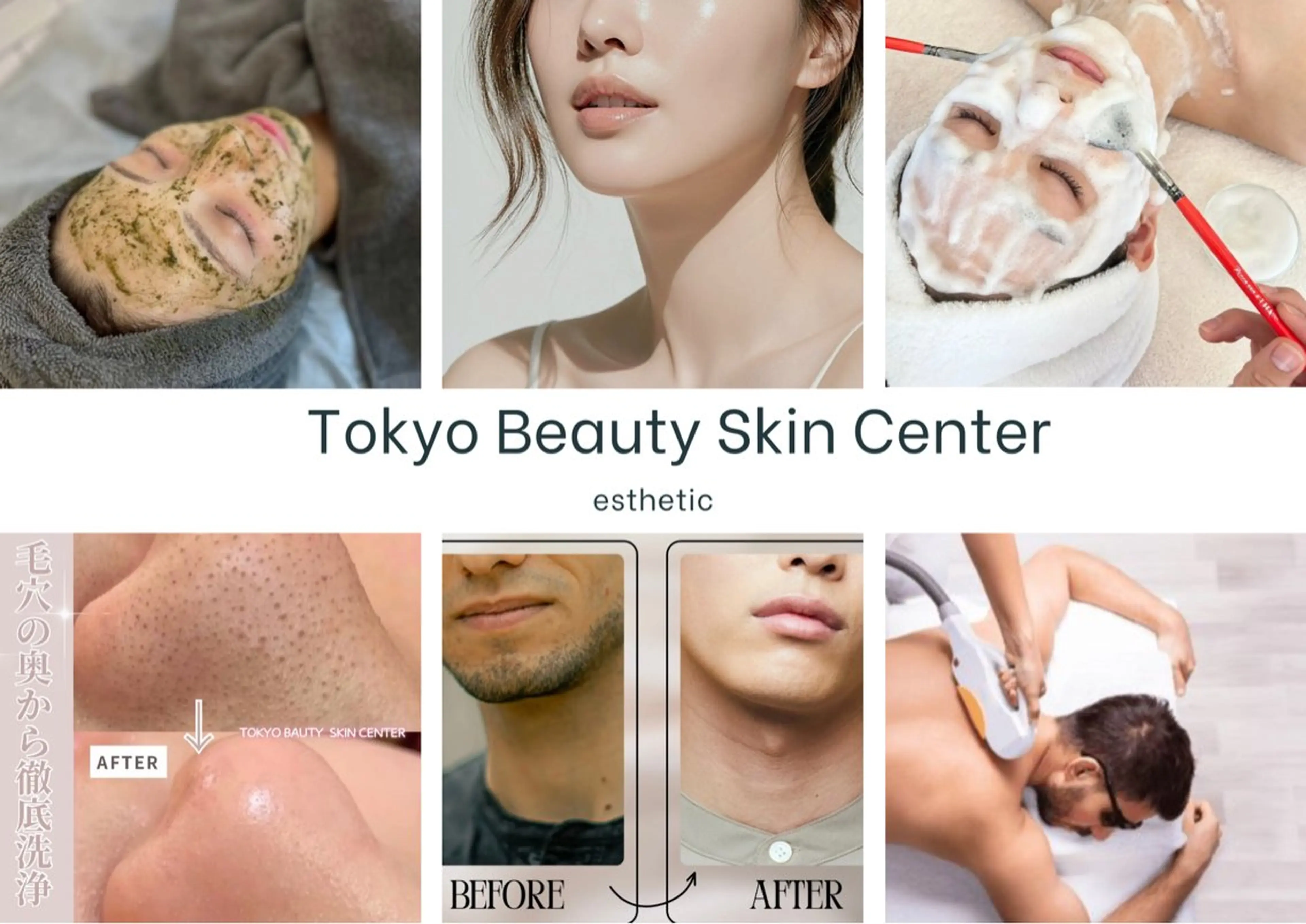 脱毛 全身脱毛&毛穴洗浄 ビューティー五反田のエステ・リラクイメージ