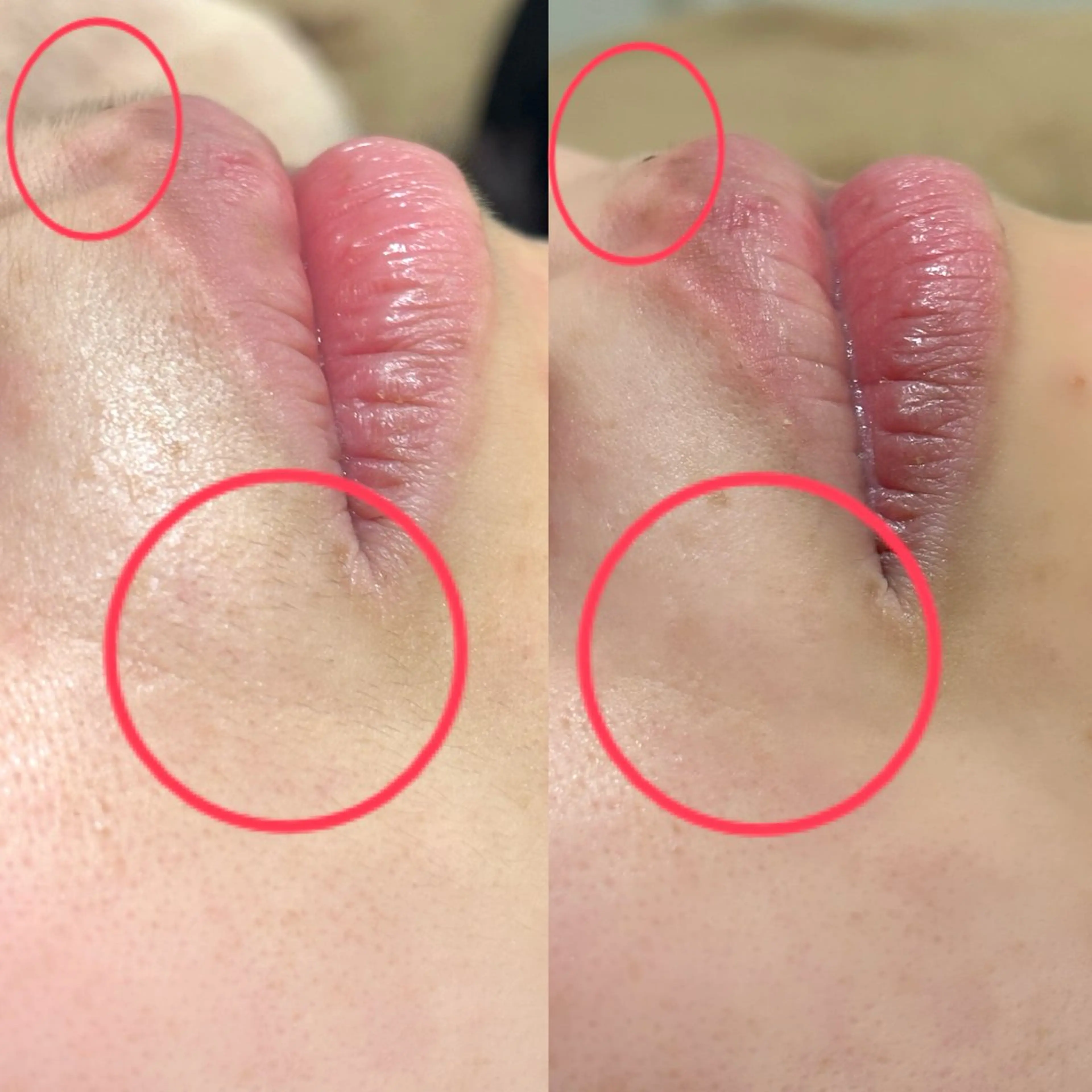 アイブロウ その他(アイブロウ) フラットラッシュ/ LEDマツエク/石原のマツエク・マツパデザイン