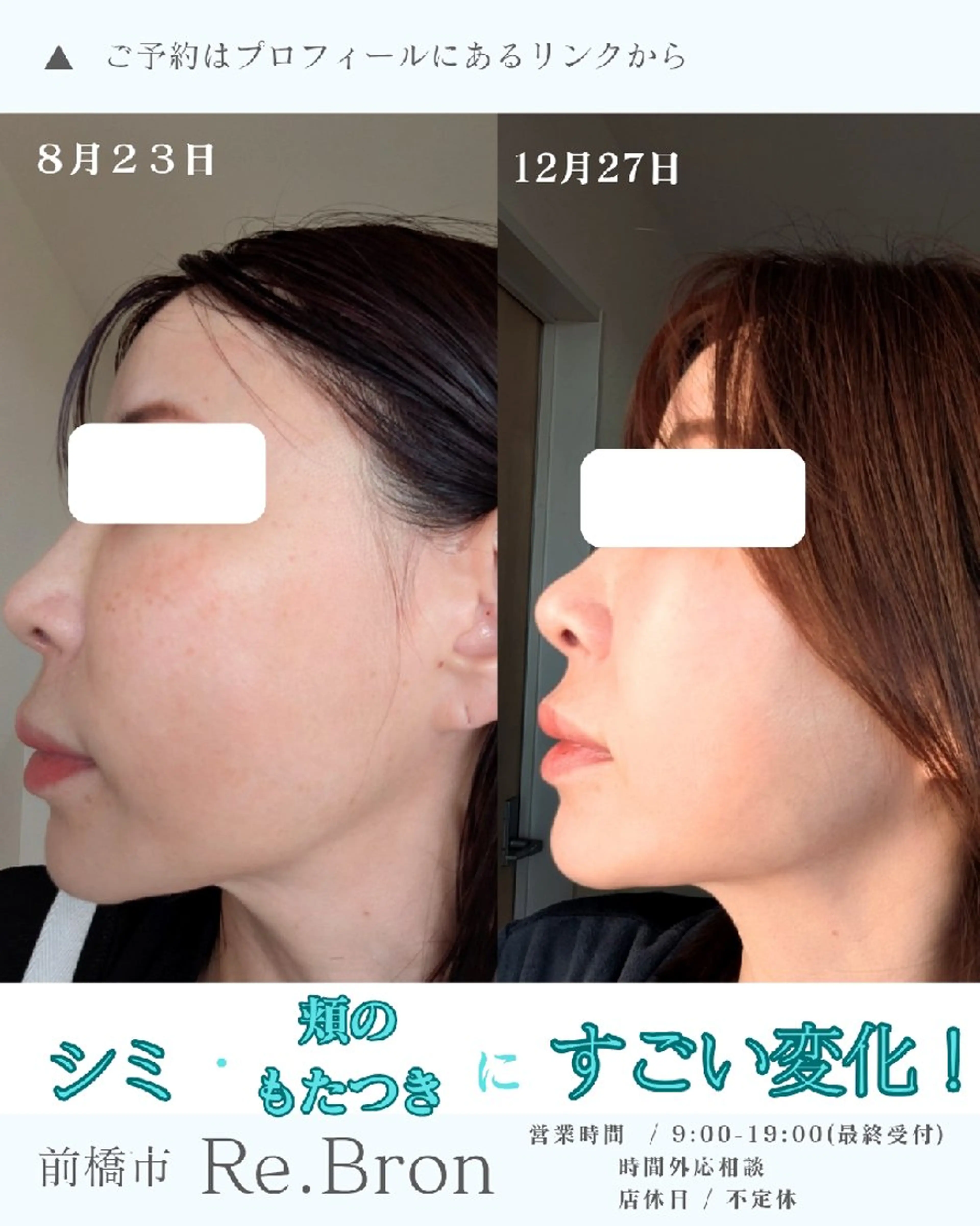 エステ リラク たるみ・ くすみ シミ・ニキビ肌改善のエステ・リラクイメージ