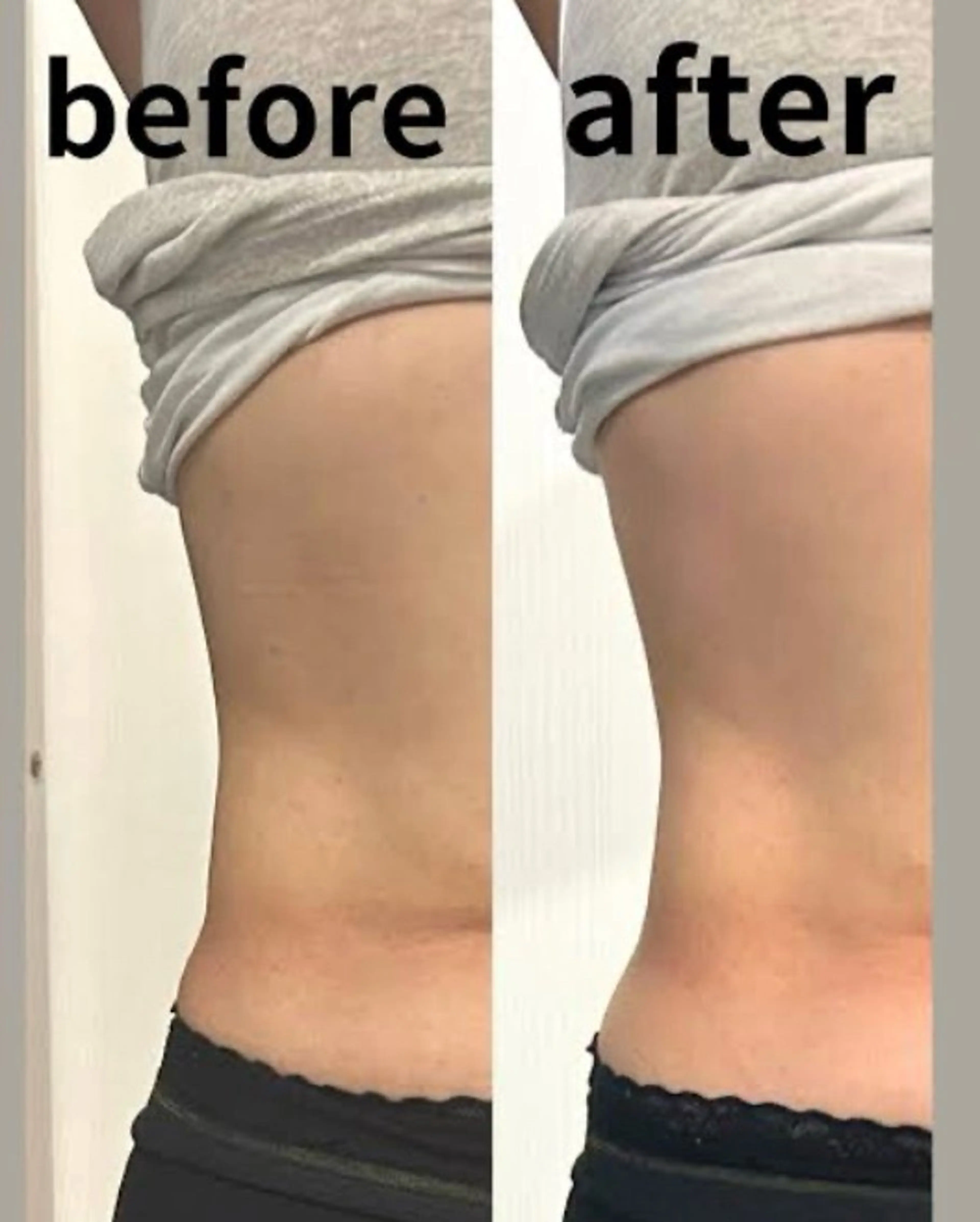 🔥空席アリ🔥✨セットメニュー✨プレミアム施術❣️バストアップ×ウエストライン引き締め✨初回🔰5800円✨の写真