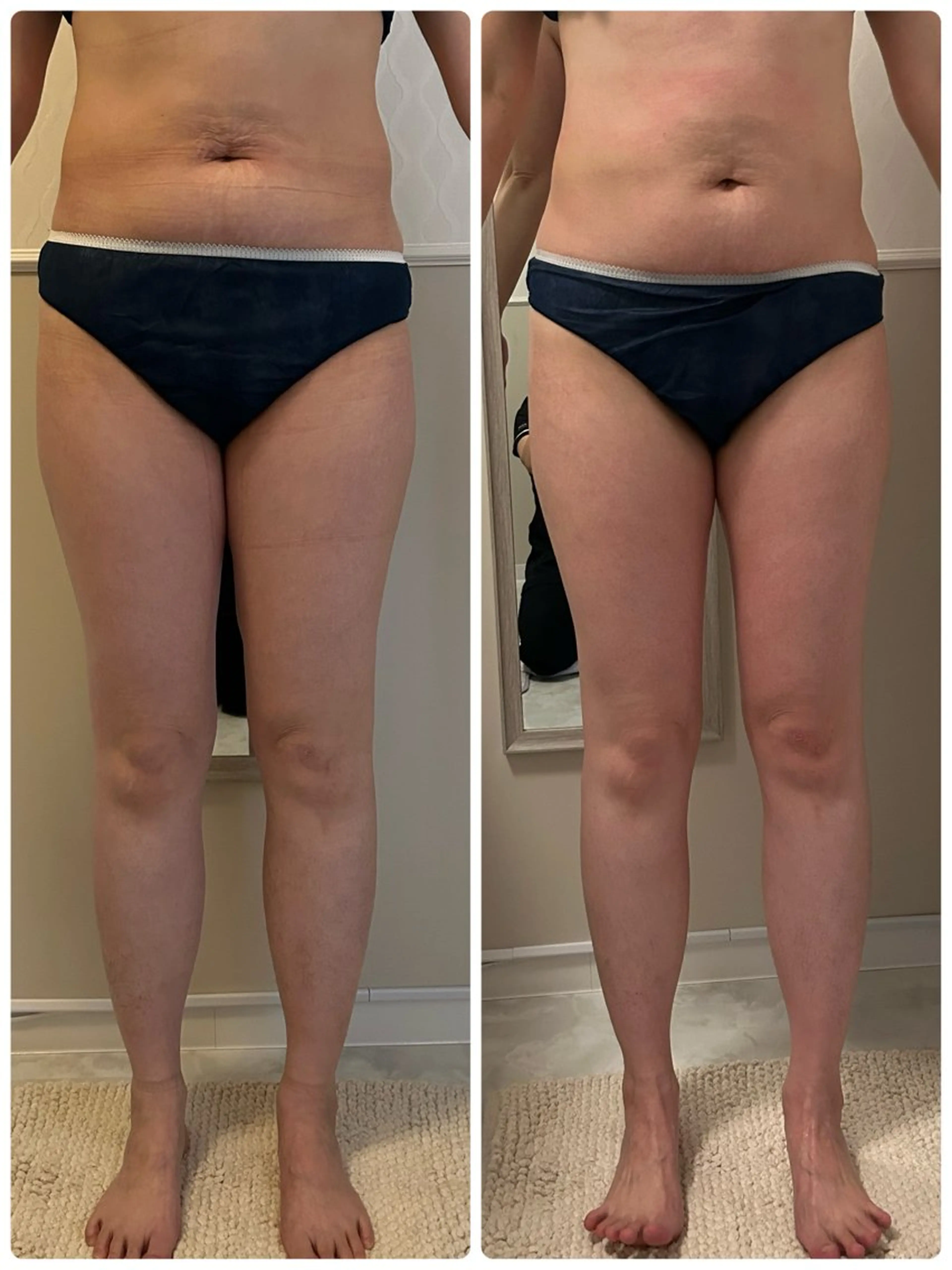 小顔美肌痩身サロン Ranのその他イメージ