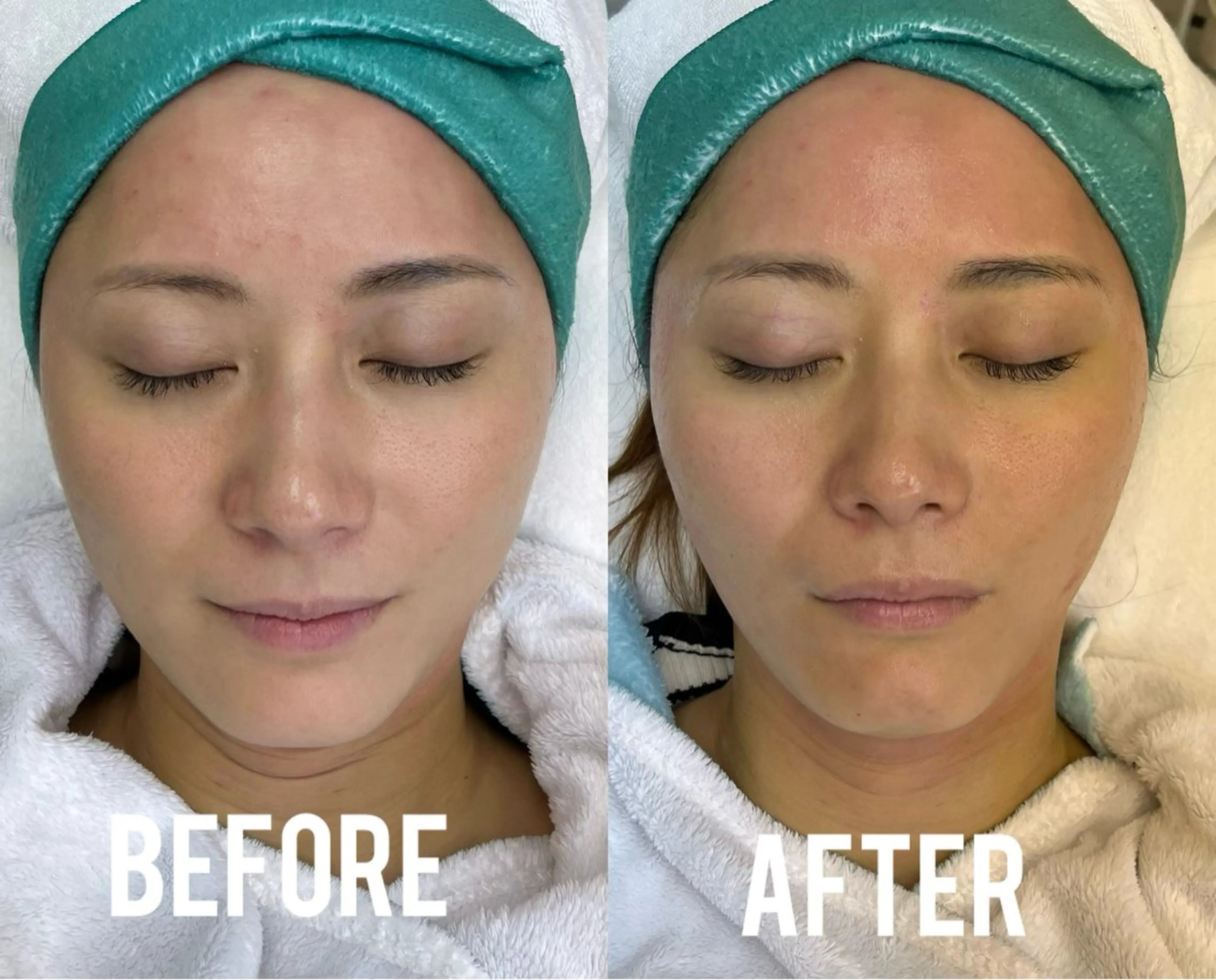 エステ 小顔、毛穴ケア 通い放題エステのエステ・リラクイメージ