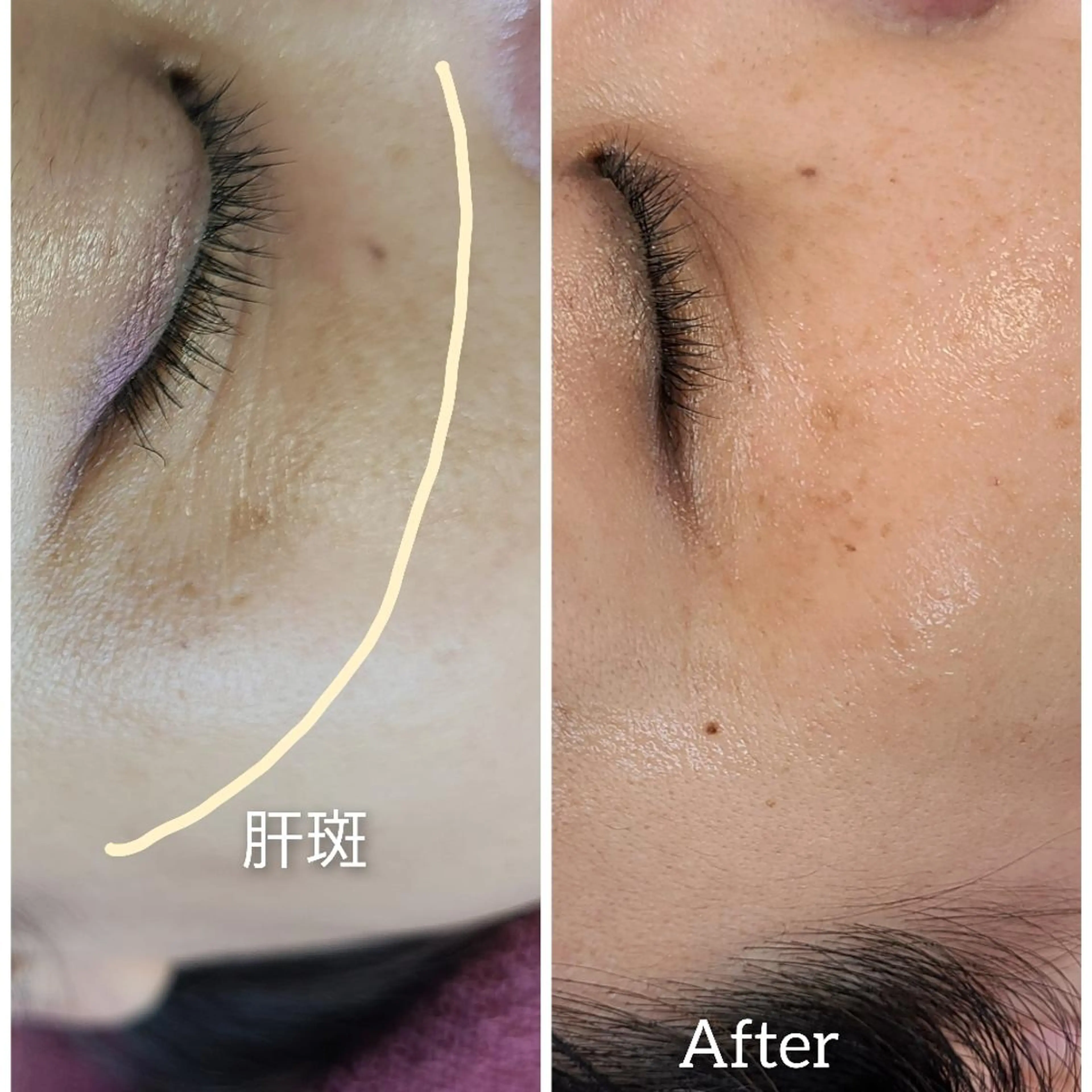 エステ パーソナルカラー・骨格/顔診断【eternity】所属・【トータル美容】 Eternityのその他イメージ