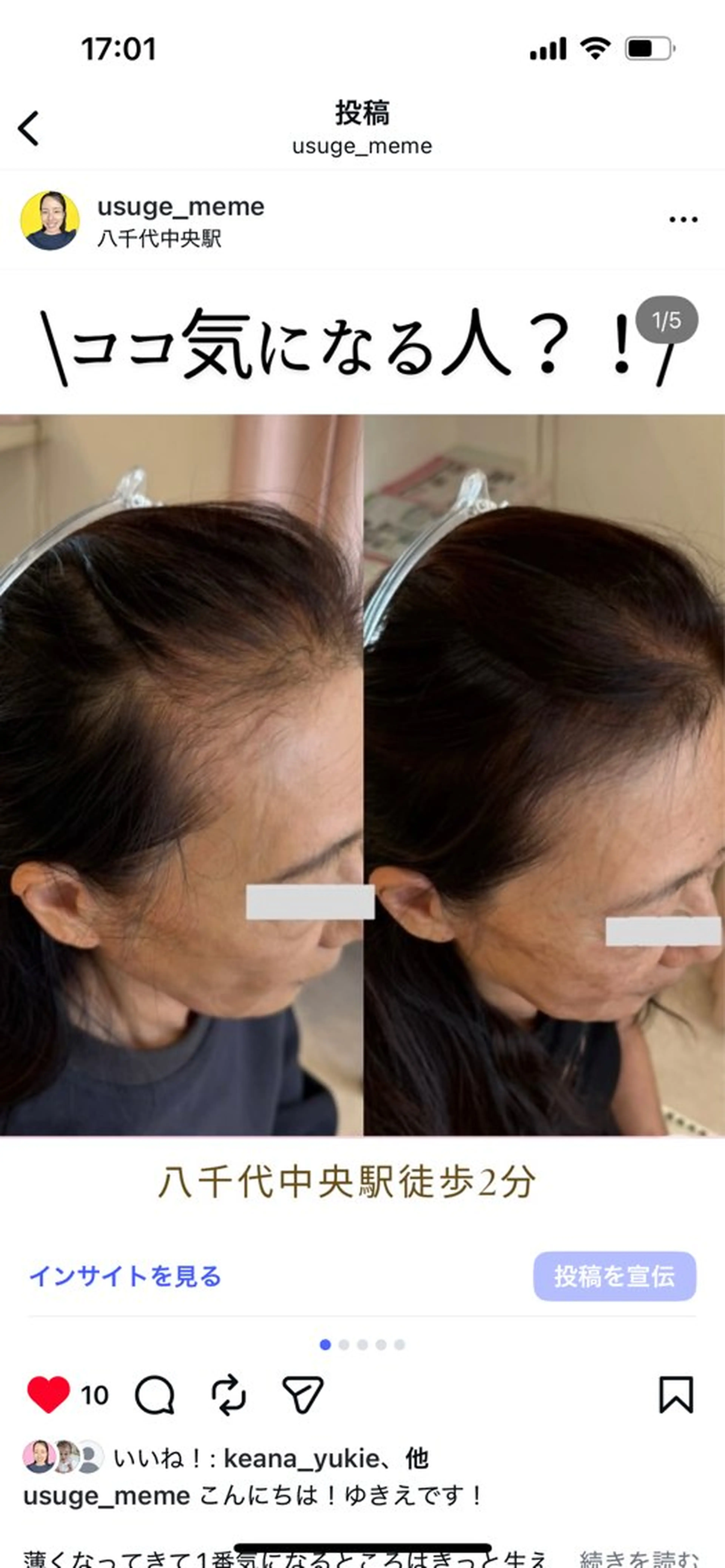 その他 毛穴・頭皮 専門店💪のその他イメージ