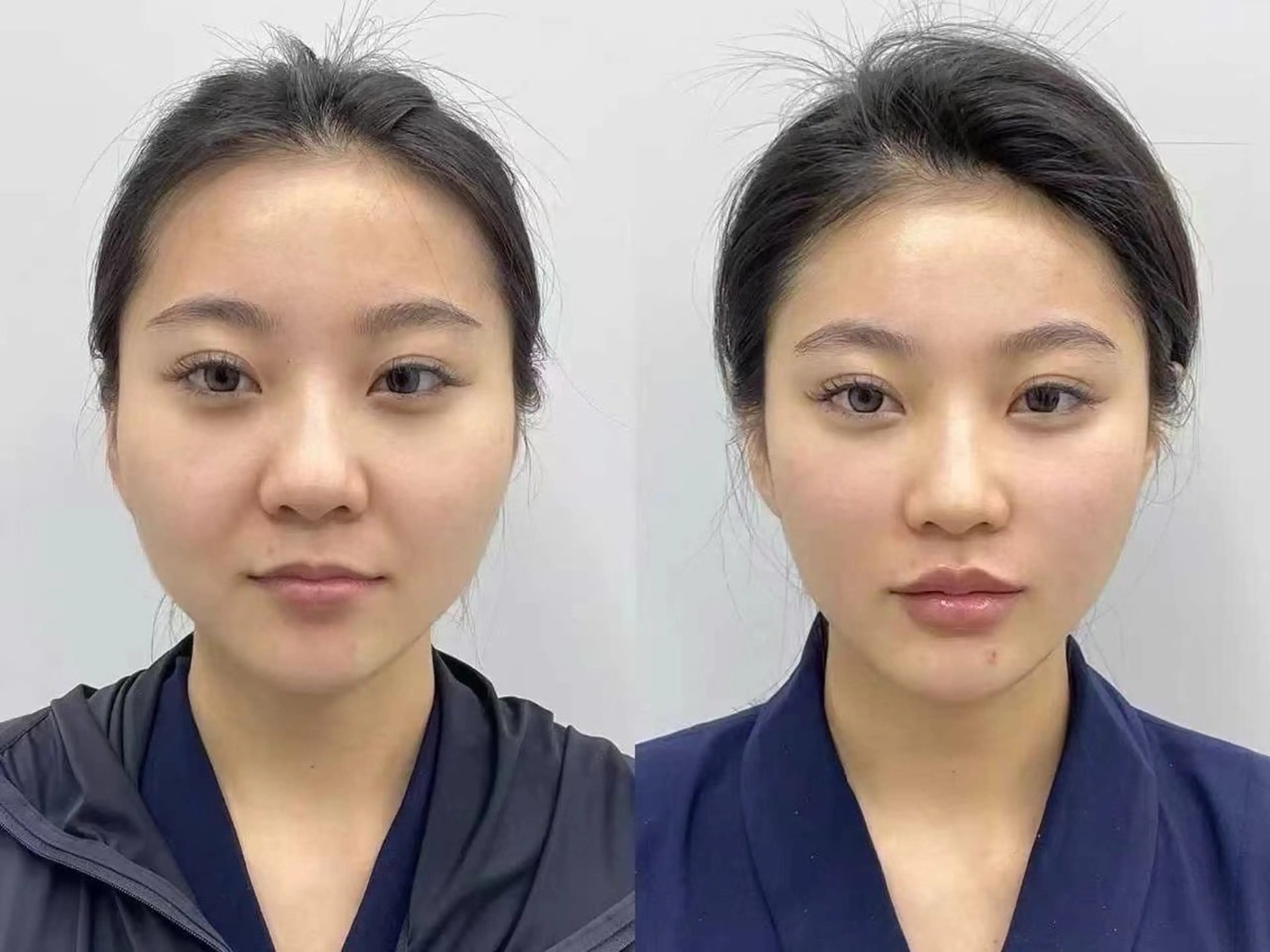 マツエク・マツパ エステ リラク 愛維美水光美肌専門店所属・愛維美水光美肌専門店 メンズレディースokのエステ・リラクイメージ