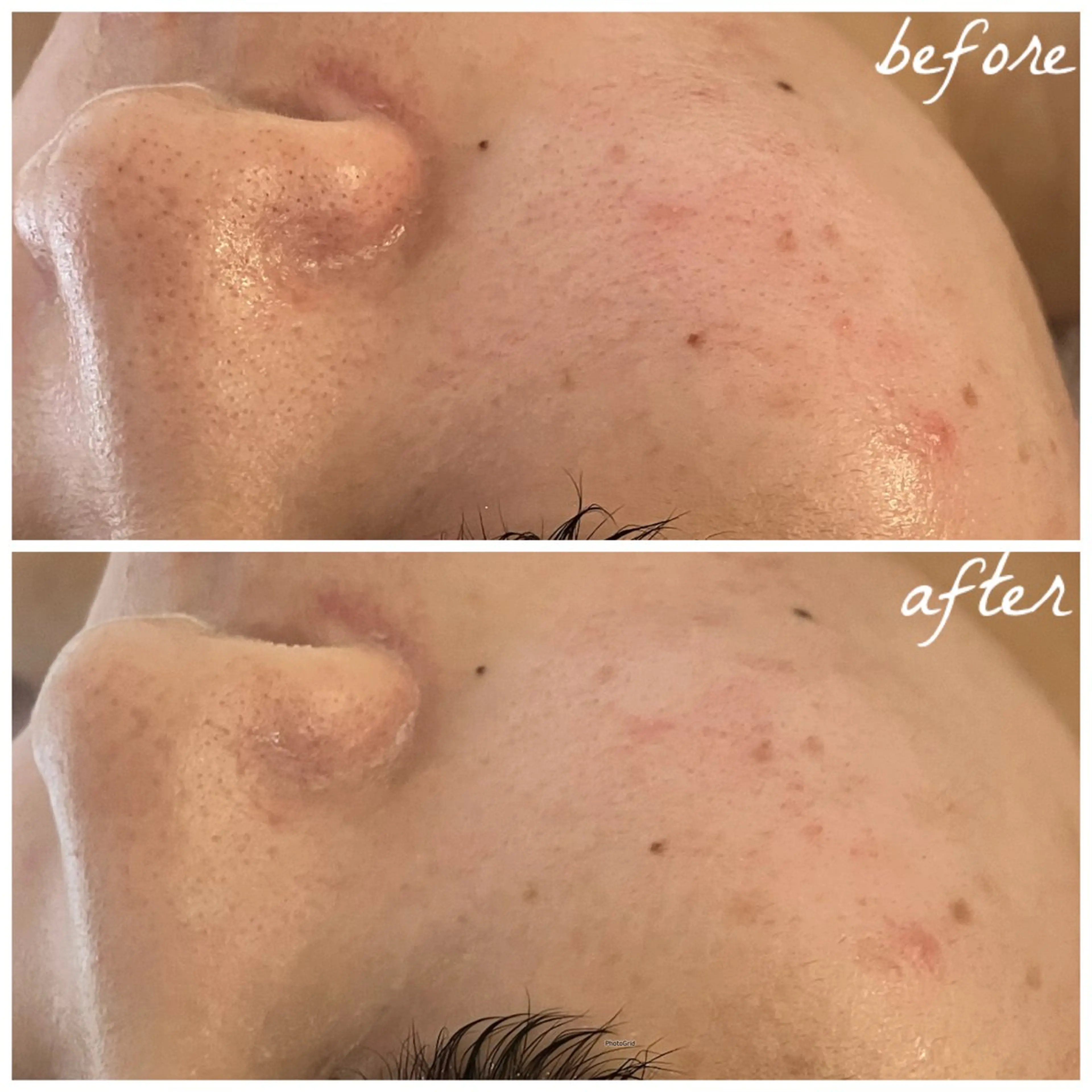 メンズ エステ メナード岐阜市茜部 杉浦のエステ・リラクイメージ