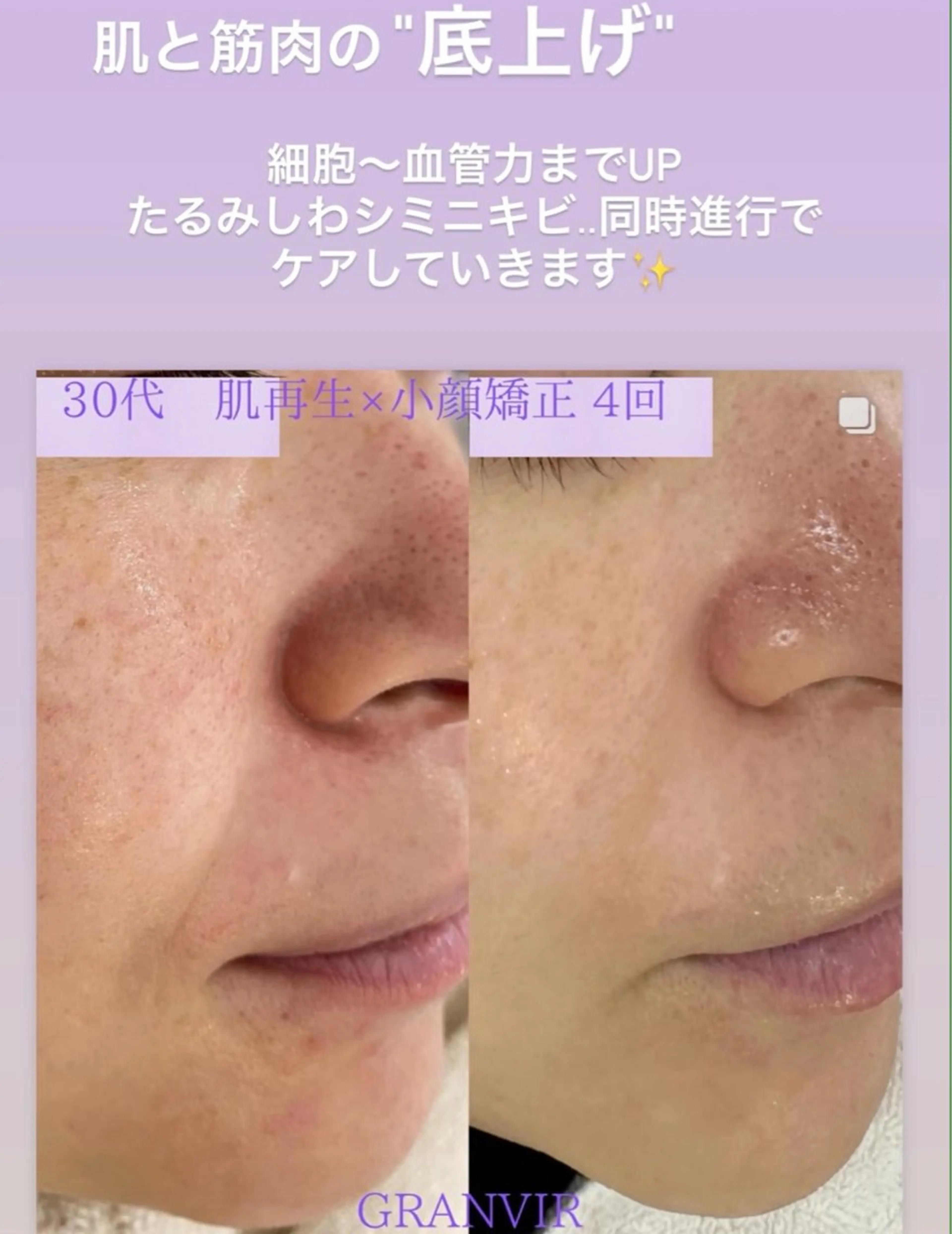 【福岡市西区 エステ】 GRANVIR(グランヴィール)所属・GRANVIR グランヴィールのエステ・リラクイメージ