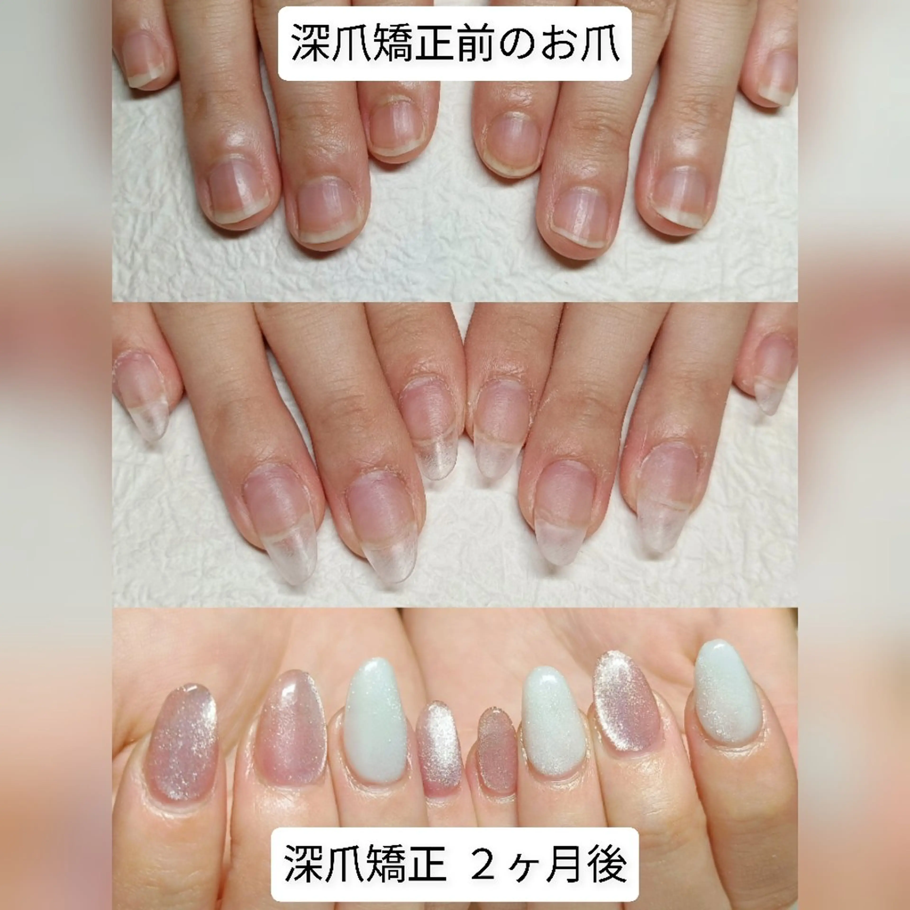 ネイル ロングネイル スカルプネイル ハンドネイル ハンドケア 深爪矯正/爪育成ケア manie nailのネイルデザイン