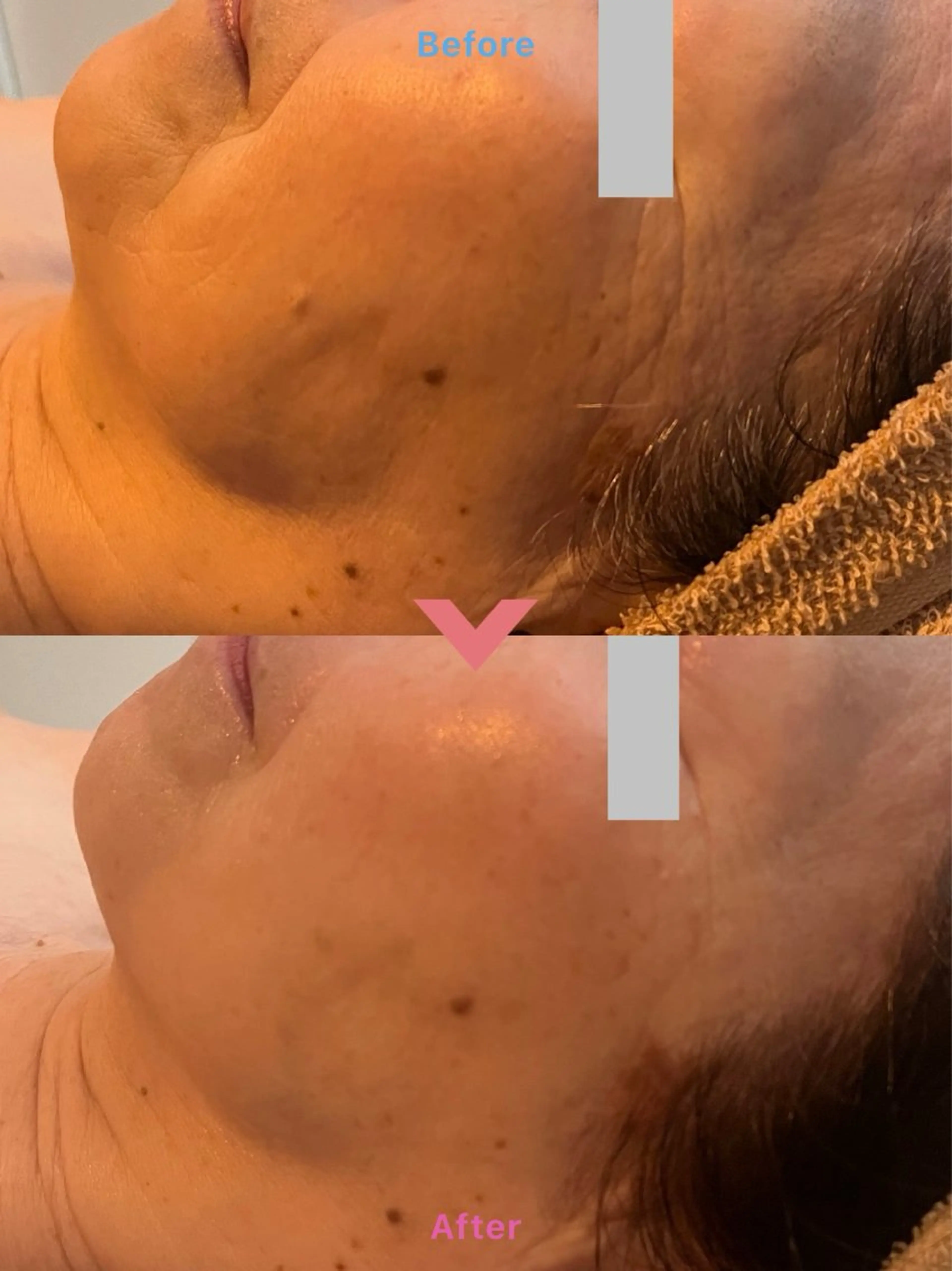 エステ エステサロン Libertaのその他イメージ