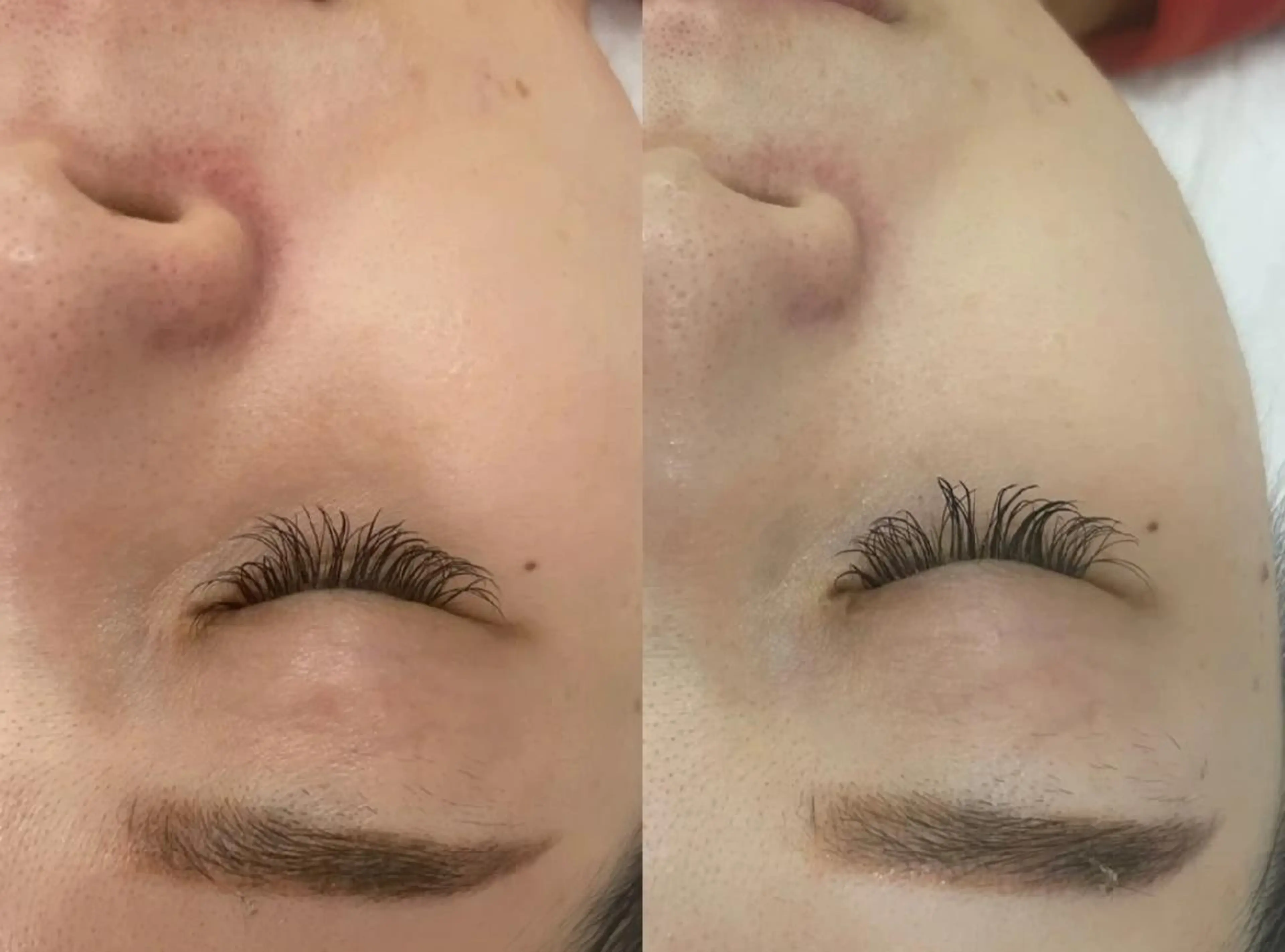 脱毛 aliaハーブ水光店 エステティシャン募集のエステ・リラクイメージ