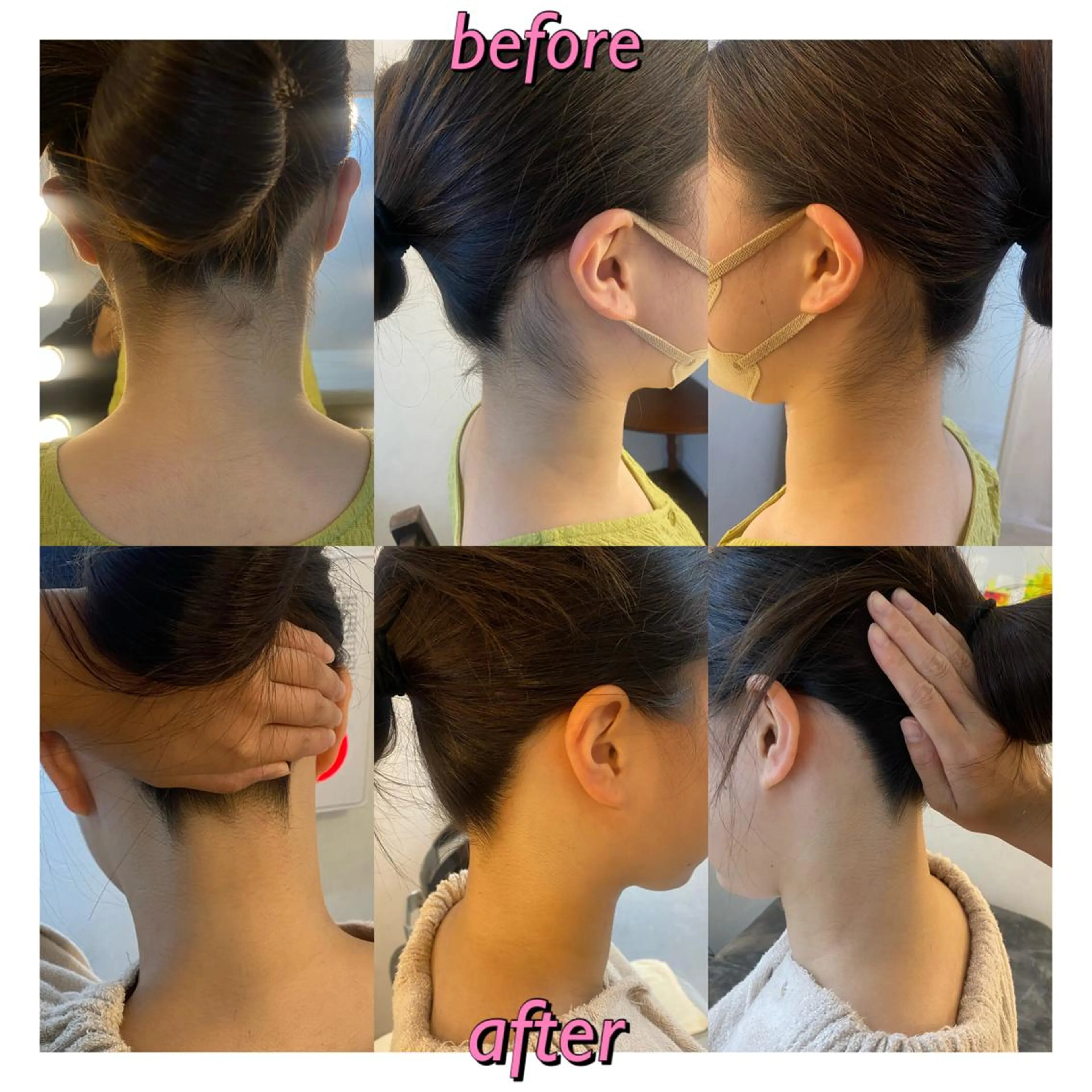 うなじ脱毛/美肌脱毛 LABELのエステ・リラクイメージ