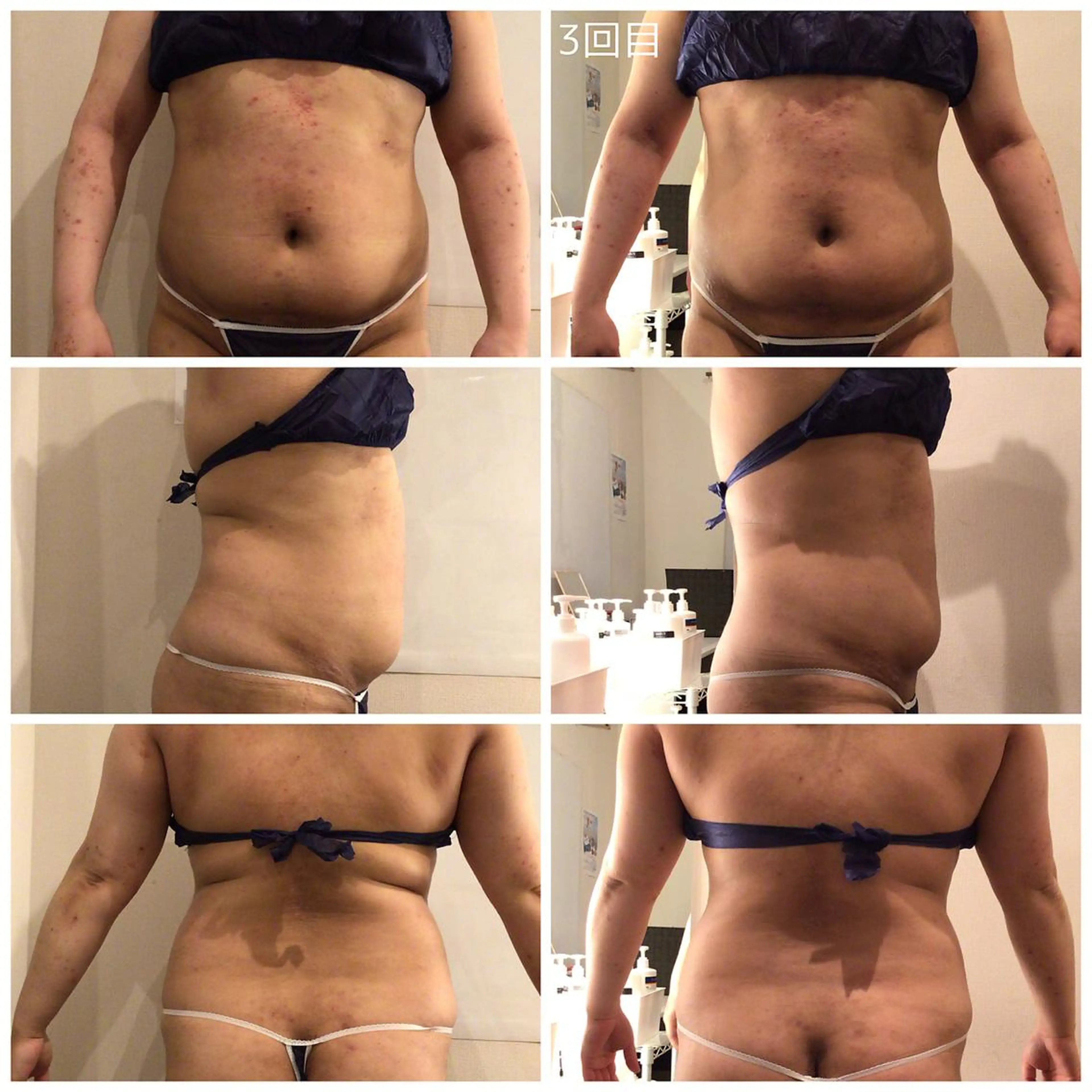 Life Salon別府店のエステ・リラクイメージ