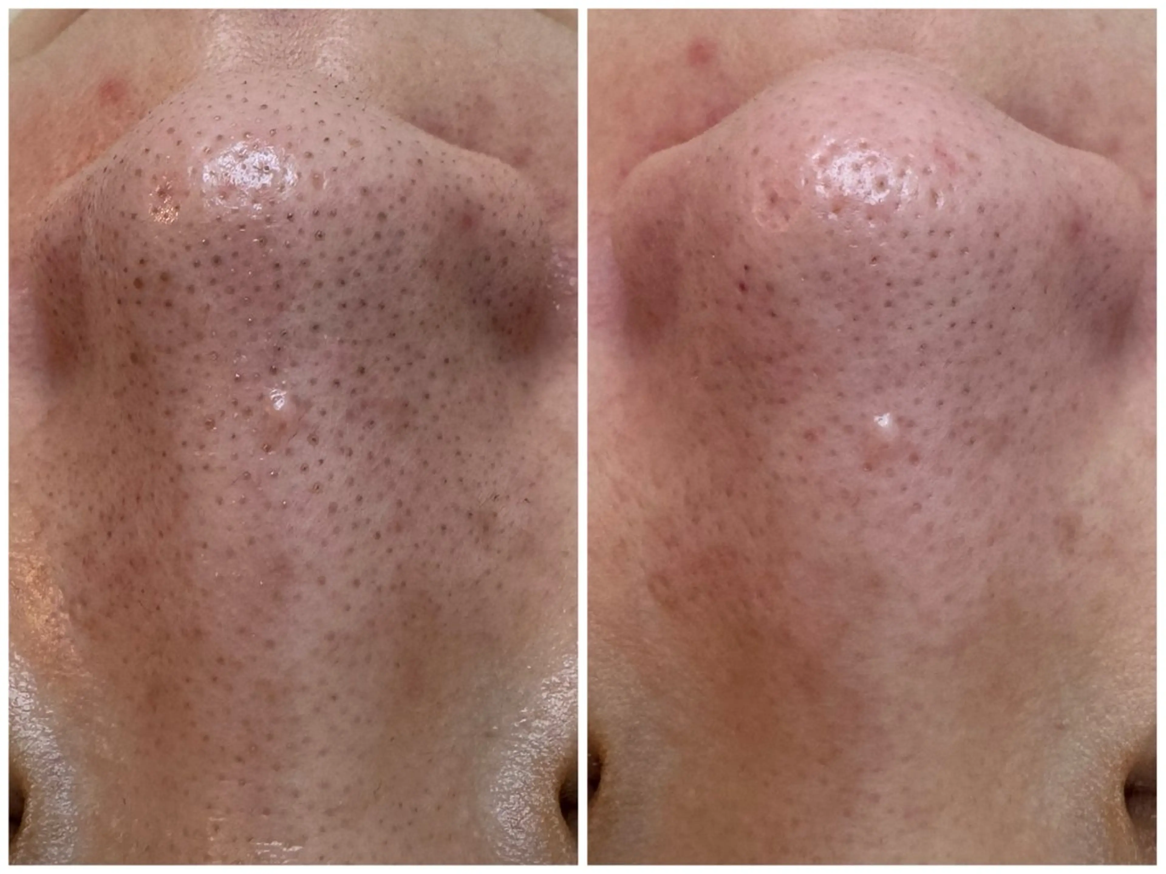 エステ リラク シミ毛穴専門店 yucca(ユッカ)のエステ・リラクイメージ