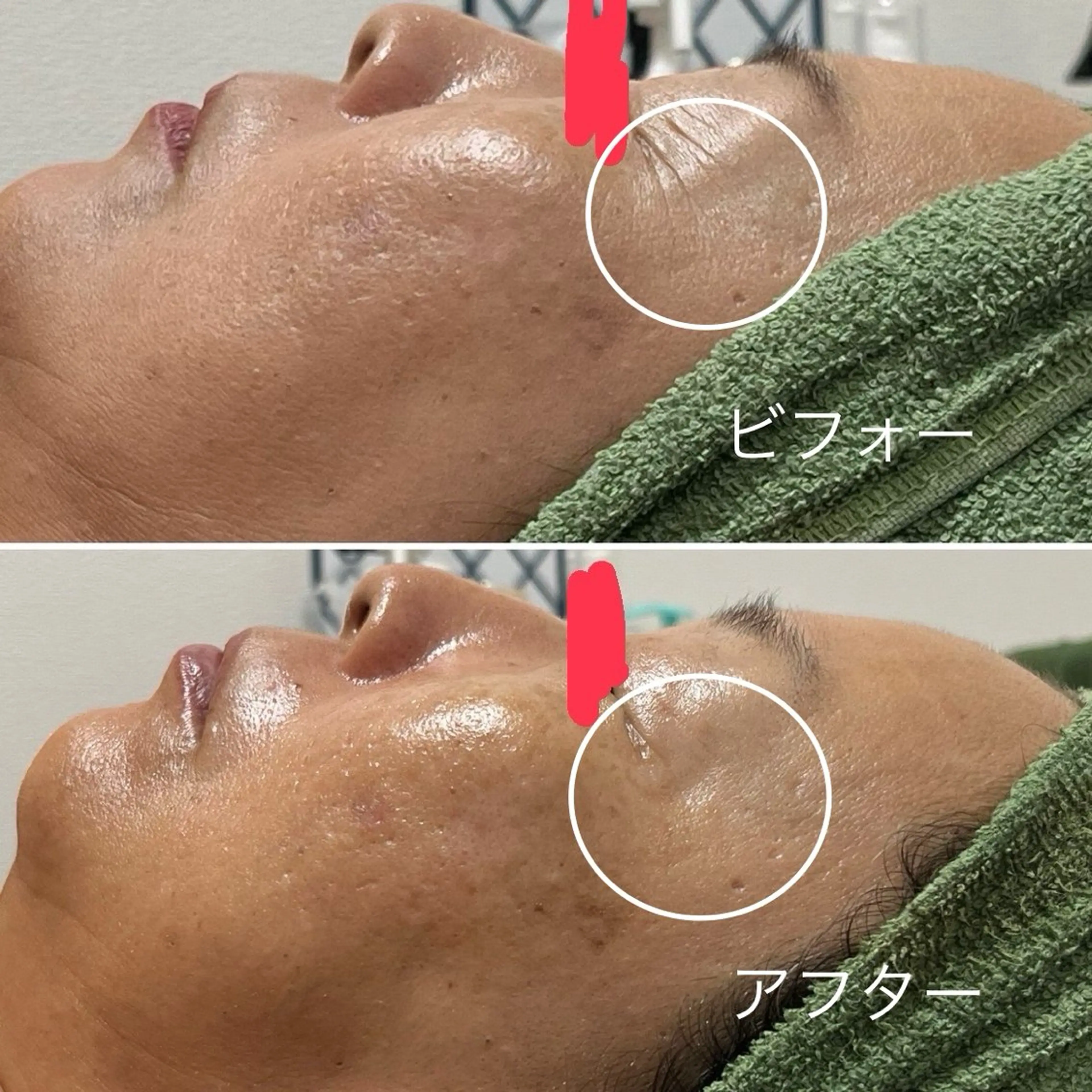 アーユルヴェーダ専門 スローガーデンのエステ・リラクイメージ