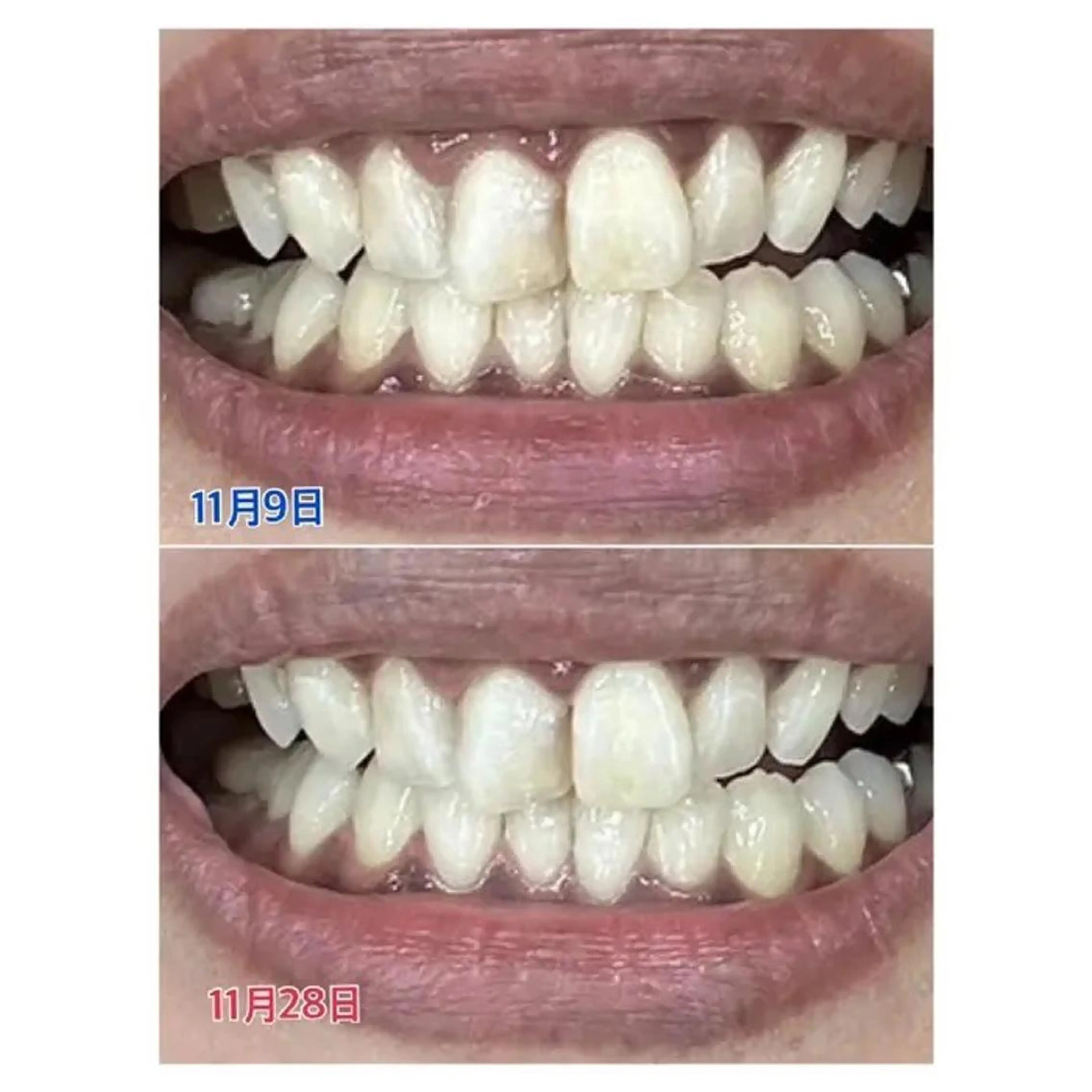 M渋谷 ホワイトニングのその他イメージ