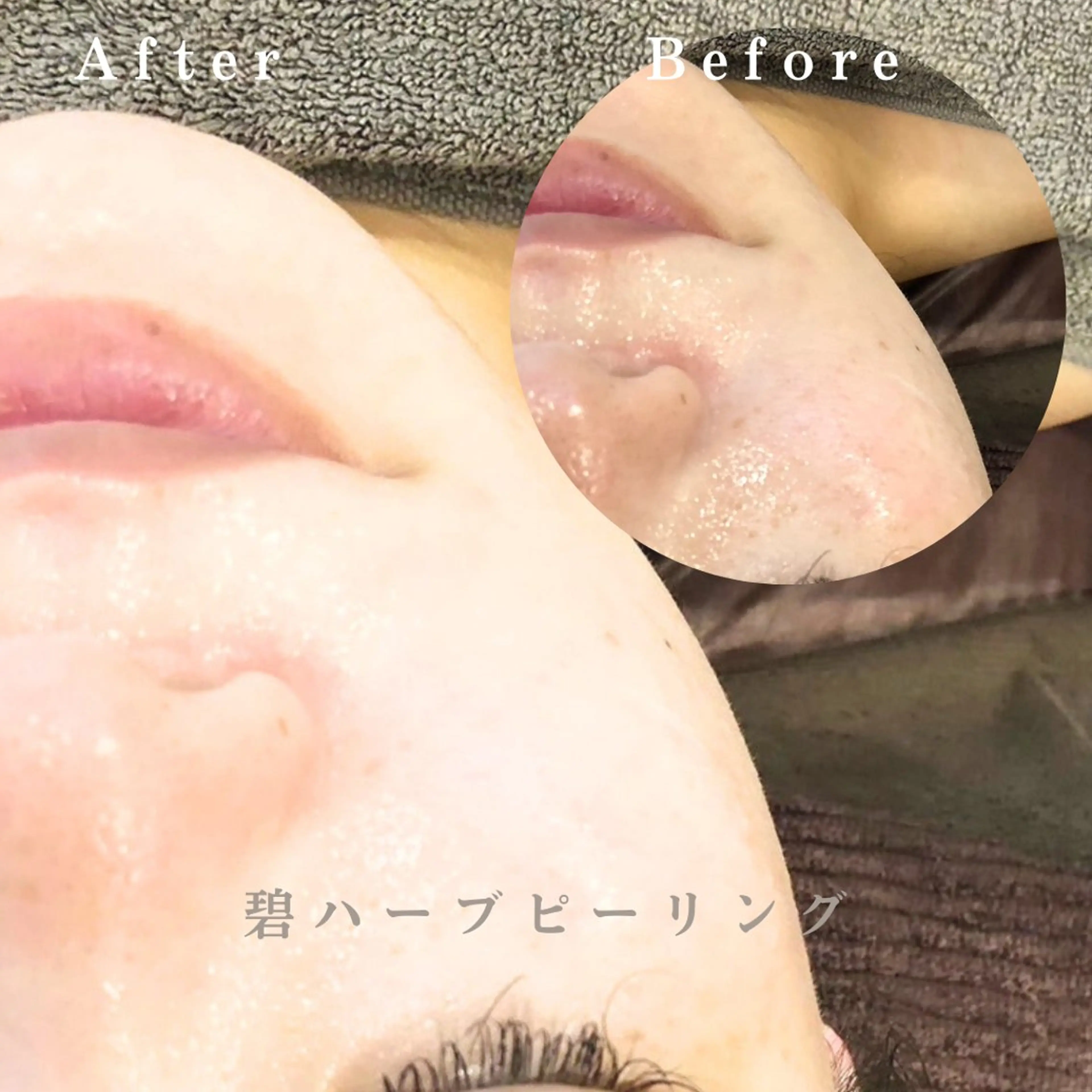 ISLABEAUTY 中目黒estheのエステ・リラクイメージ