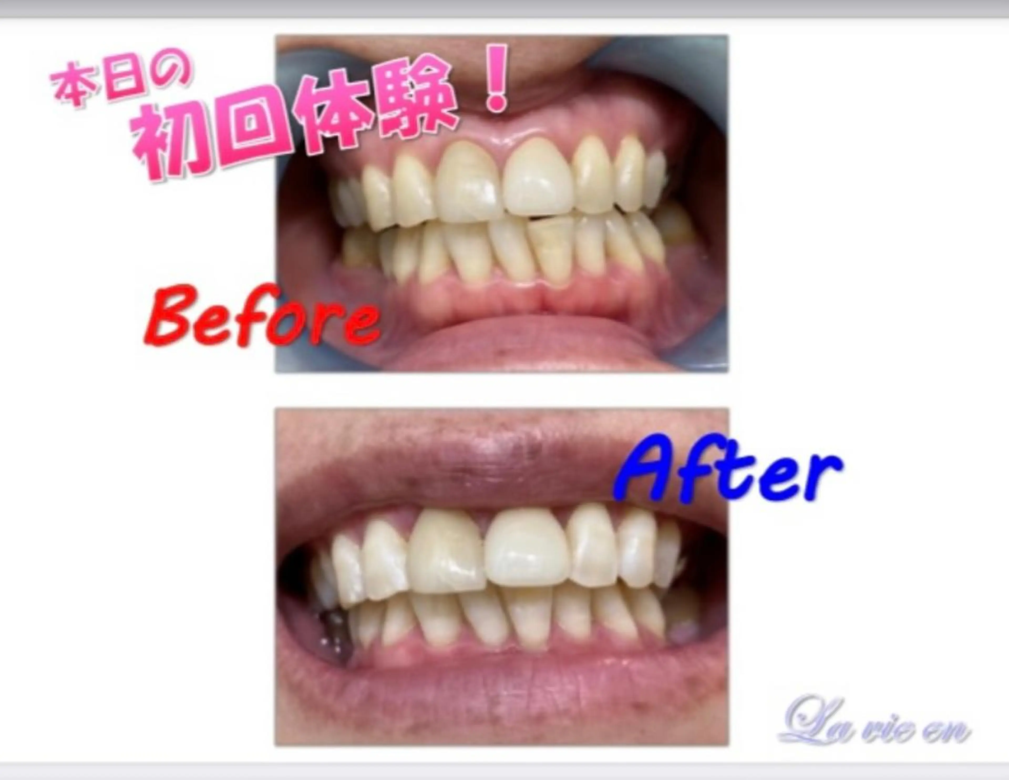 その他 セルフホワイトニングサロン　ラヴィアン所属・ホワイトニングサロン La vie enのその他イメージ
