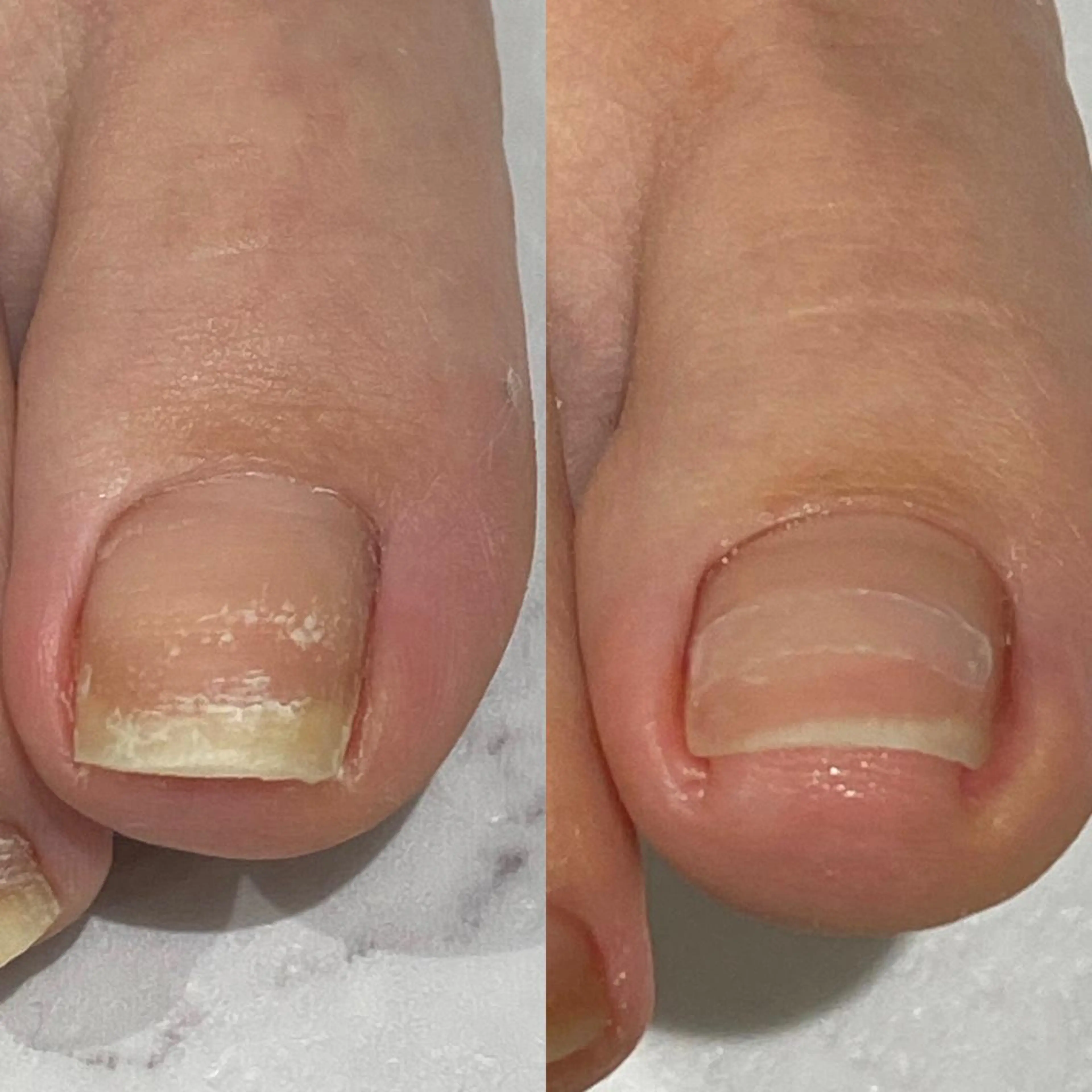 ネイル フットネイル プライベートサロン Rのネイルデザイン