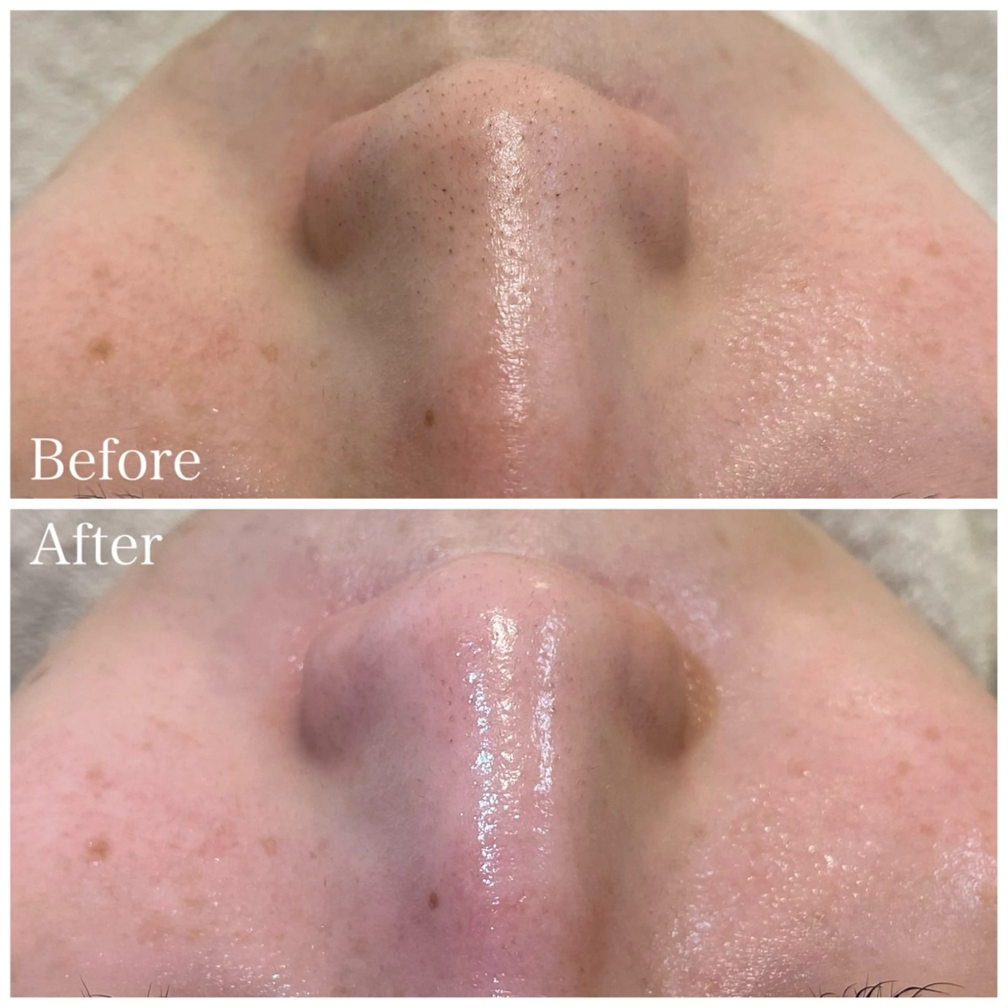 Nna 韓国肌管理のエステ・リラクイメージ