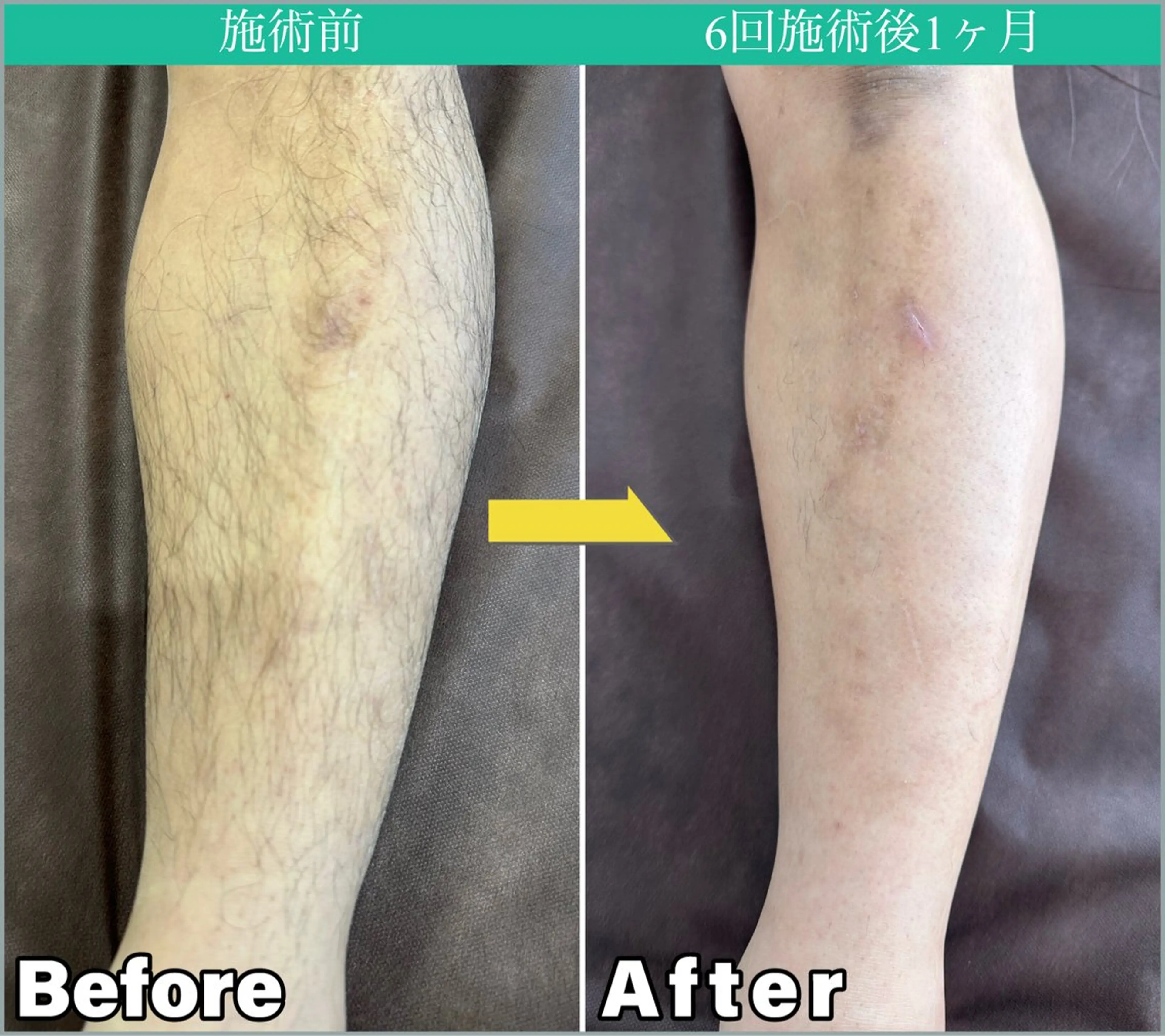 メンズ JONRY所属・JONRY (ジョンリー)のエステ・リラクイメージ