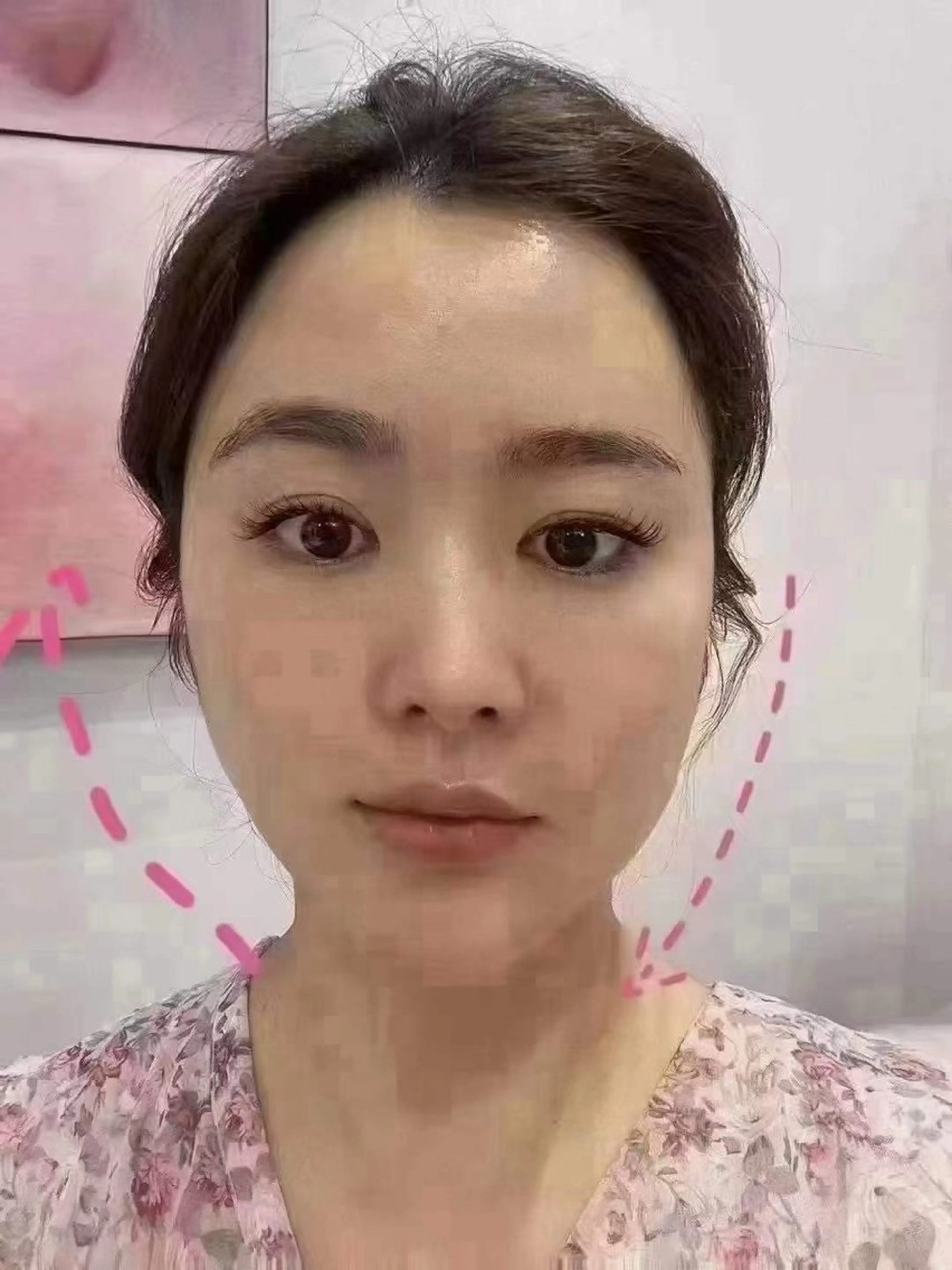 ネイル エステ aliaハーブ水光店 エステティシャン募集のエステ・リラクイメージ