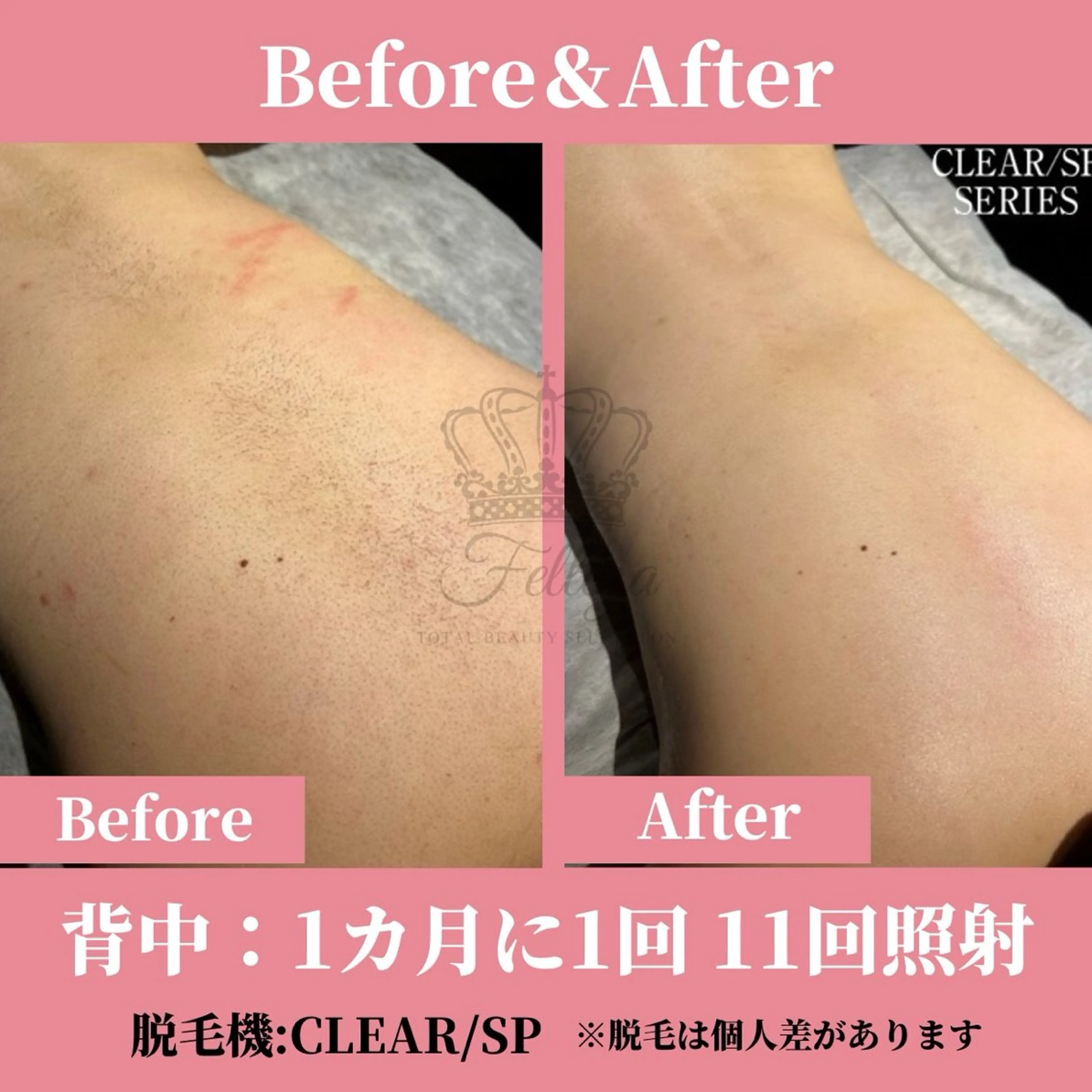 メンズ キッズ 有人型セルフサロン 脱毛／痩身／美顔のエステ・リラクイメージ