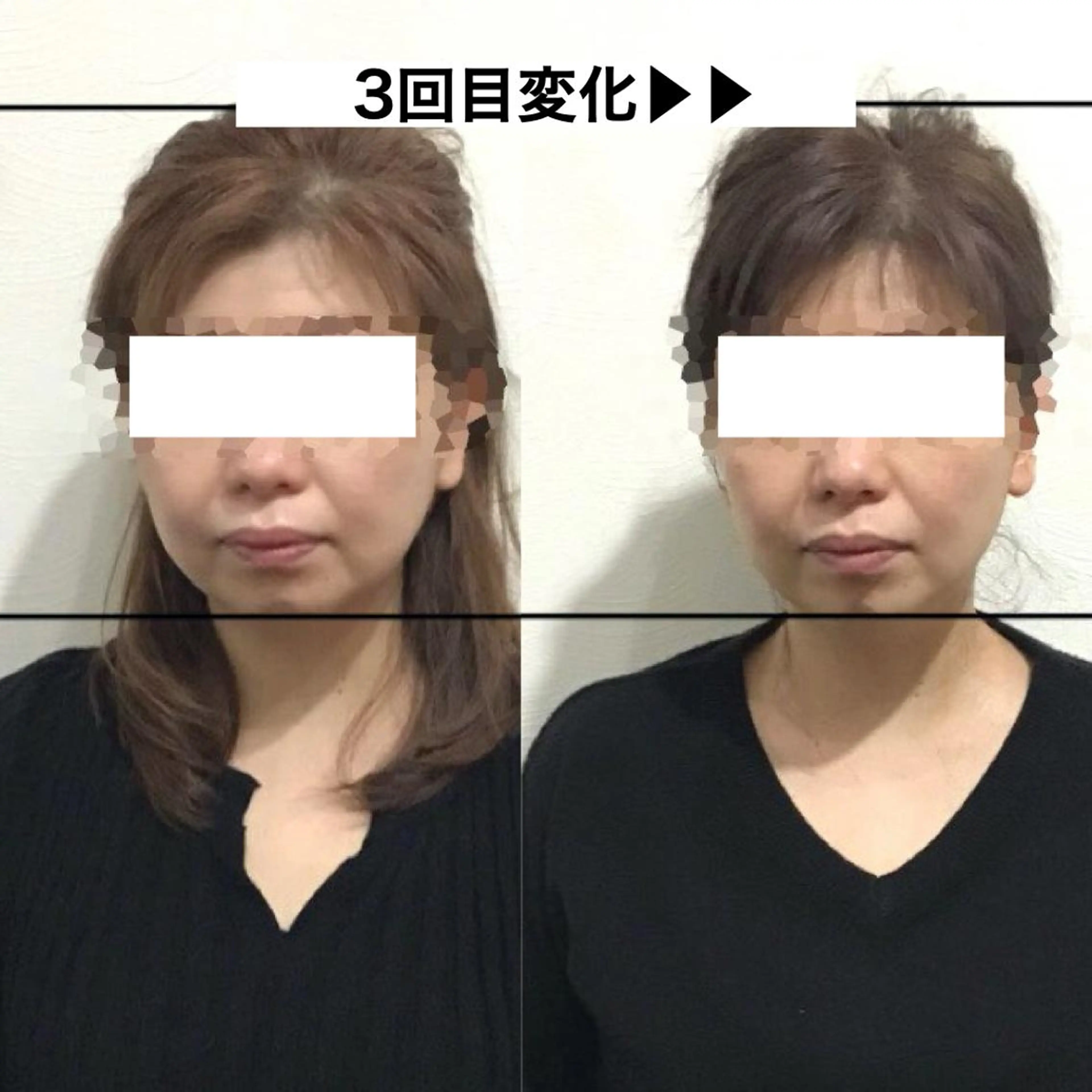 顔の歪み矯正専門 宮内翔のエステ・リラクイメージ