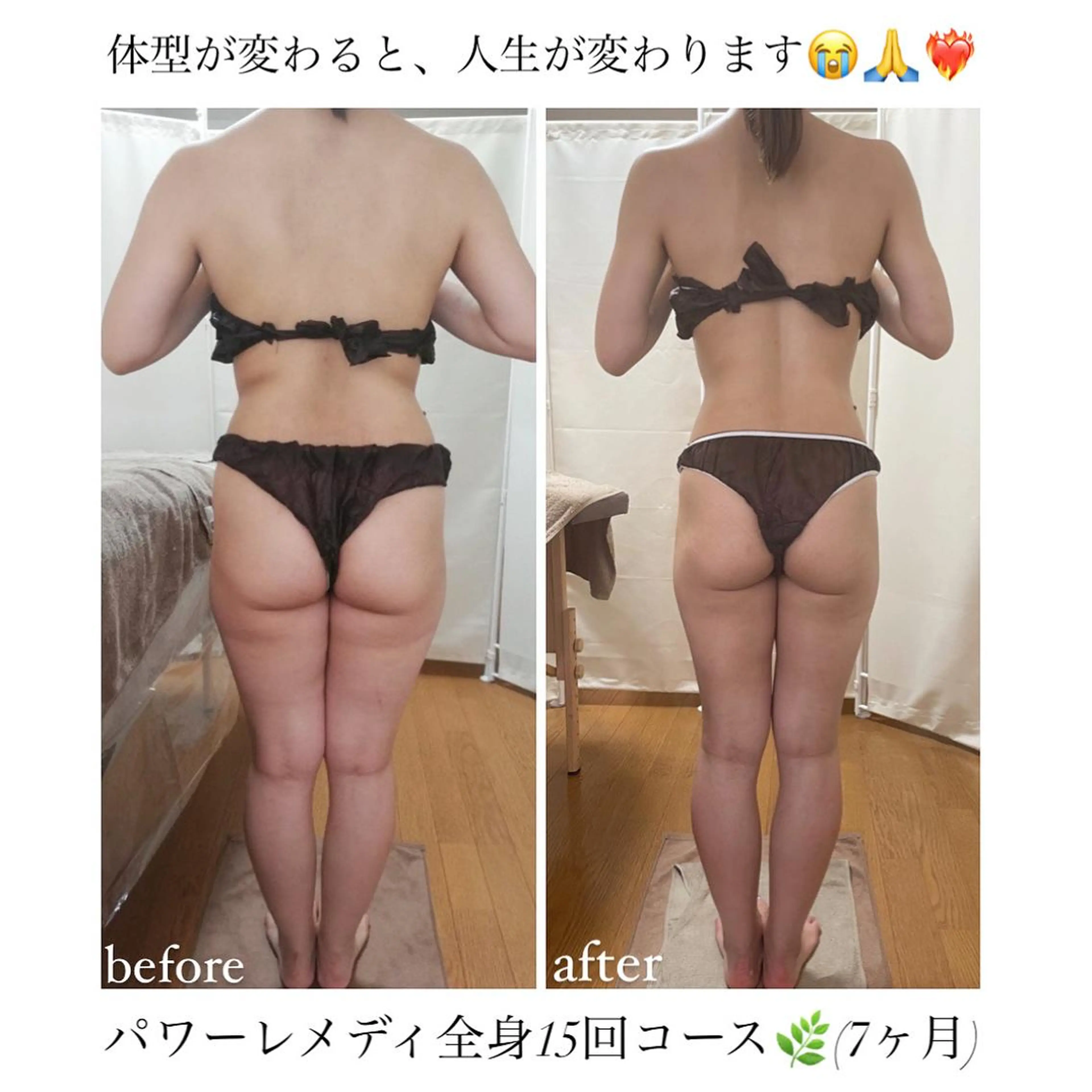 《本気痩せ×疲労改善 》  BILOOPのエステ・リラクイメージ