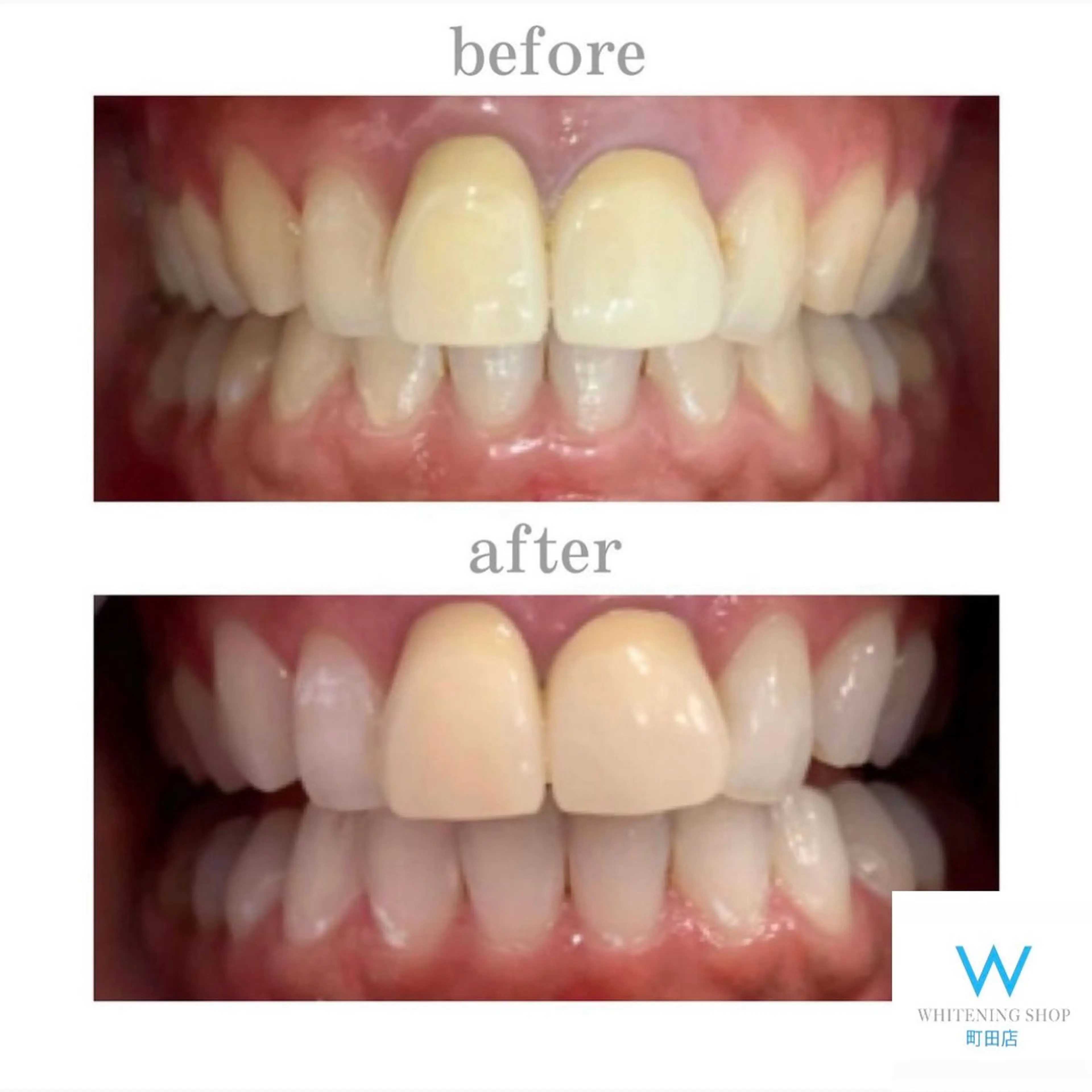 メンズ キッズ その他 ホワイトニング ショップ町田店のその他イメージ