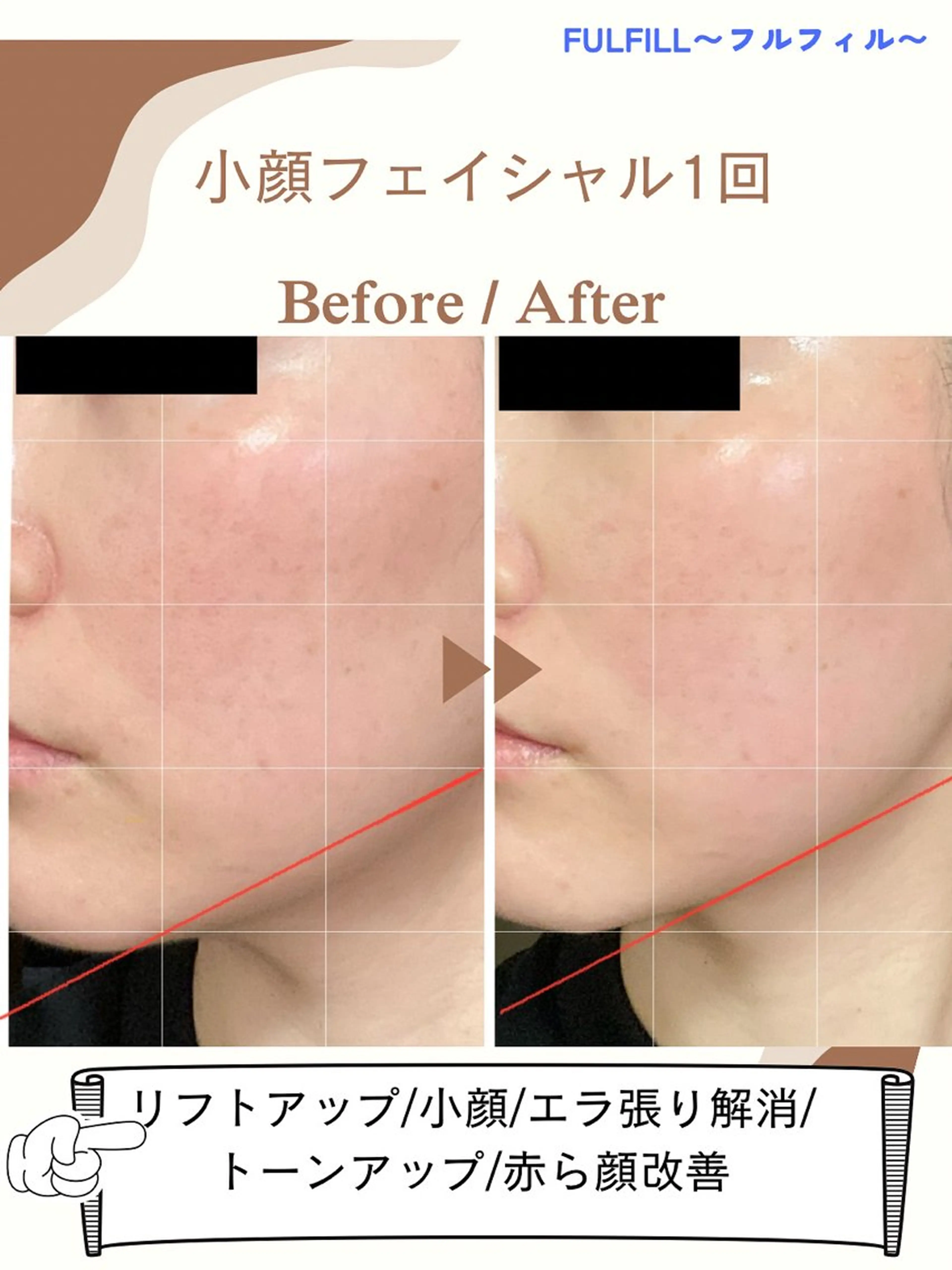 エステ リラク フルフィル名取美田園 MIYUKIのエステ・リラクイメージ