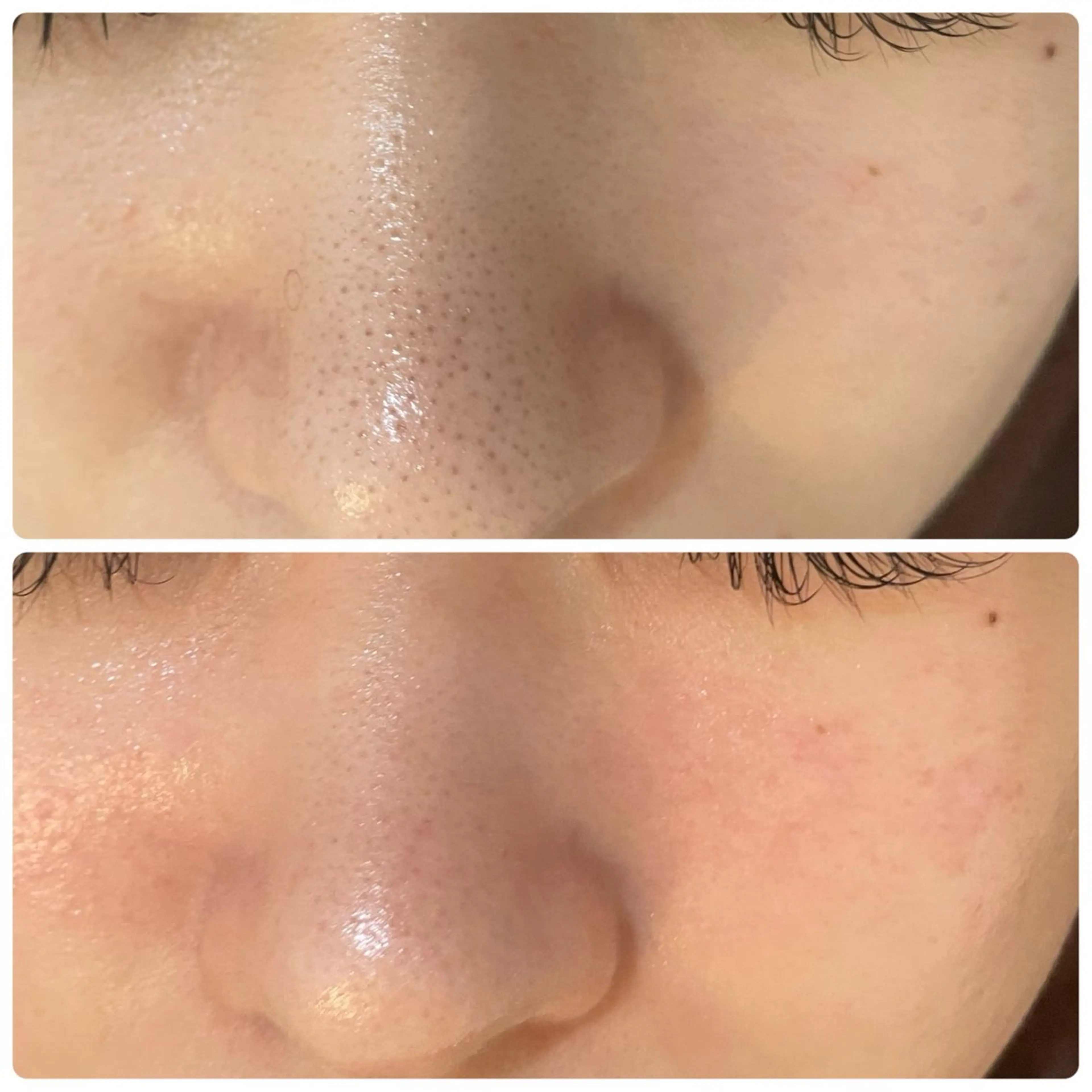 姫路/肌管理/脱毛 Le Cherienのその他イメージ