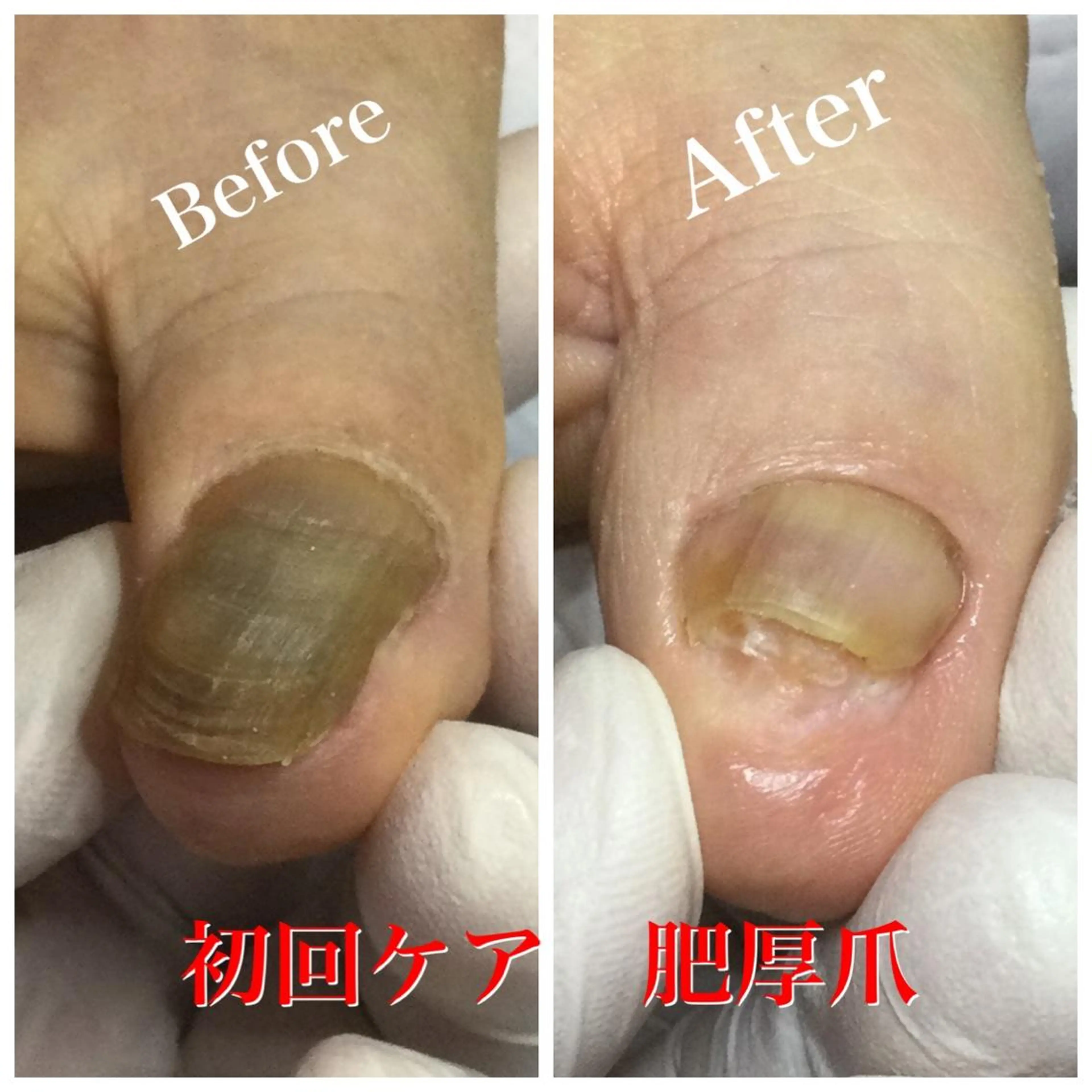 メンズ ネイル その他 ドクターネイル爪革命 takahashiのその他イメージ